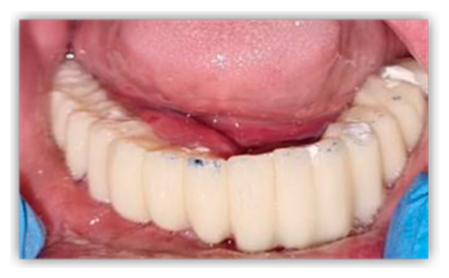 Healthcare 11 01608 g006 Healthcare 11 01608 g006