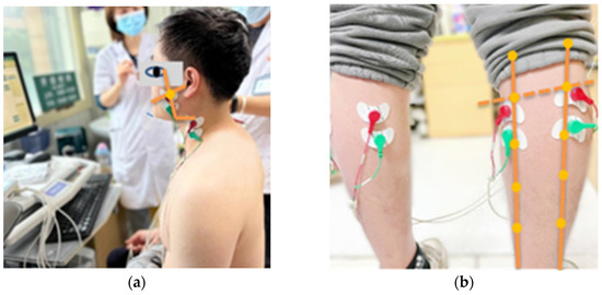 Healthcare 11 01718 g001