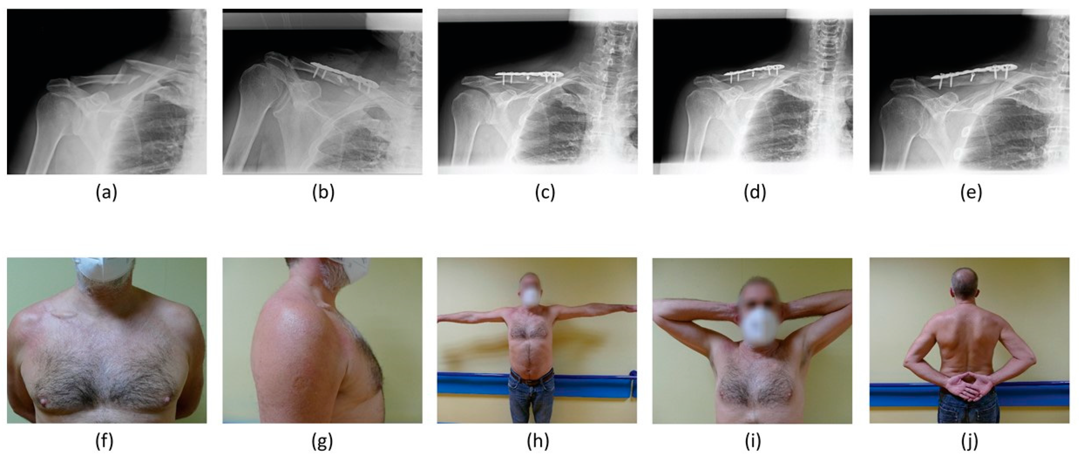 Healthcare 11 01883 g004