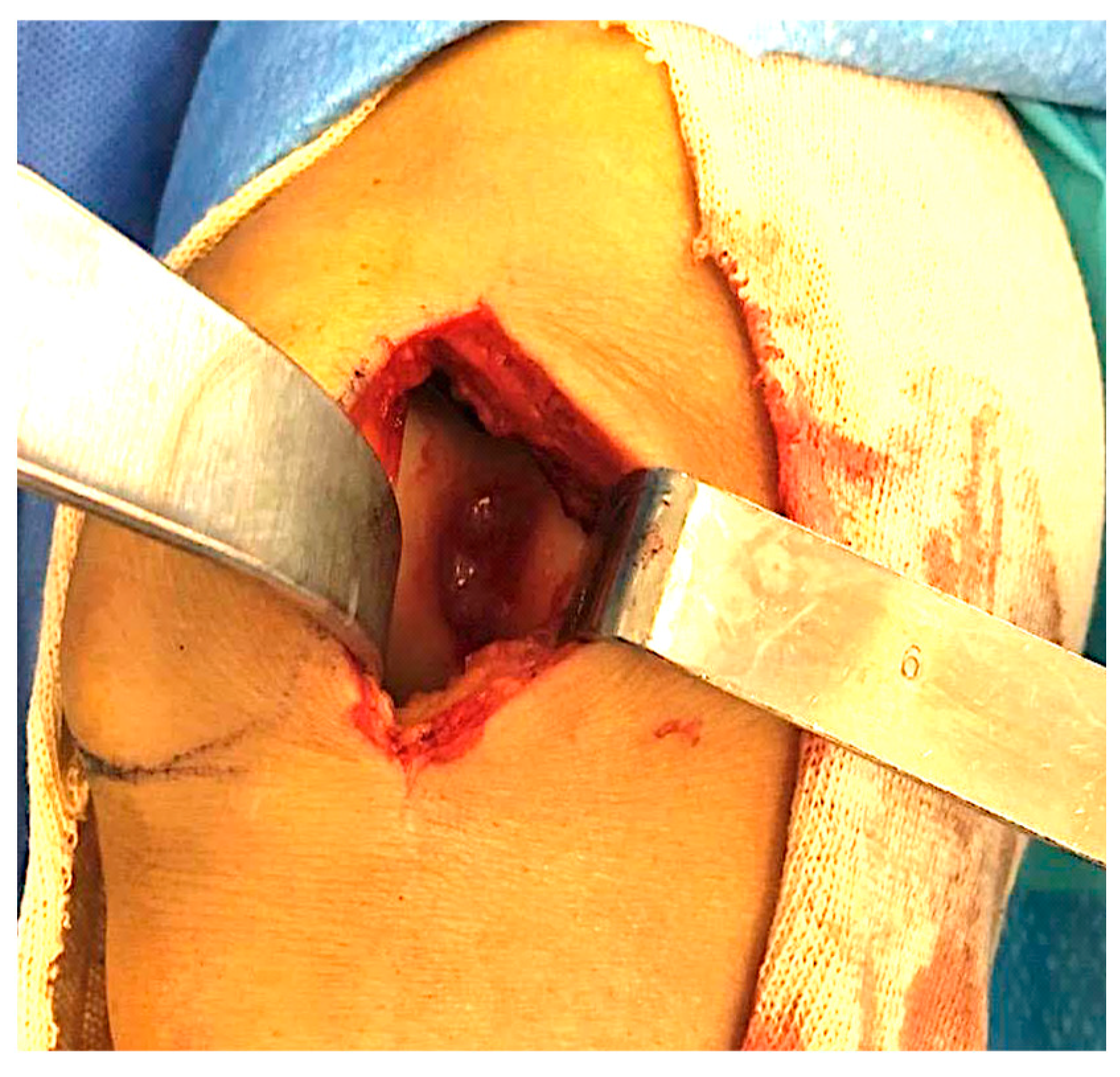 Healthcare 11 02995 g002