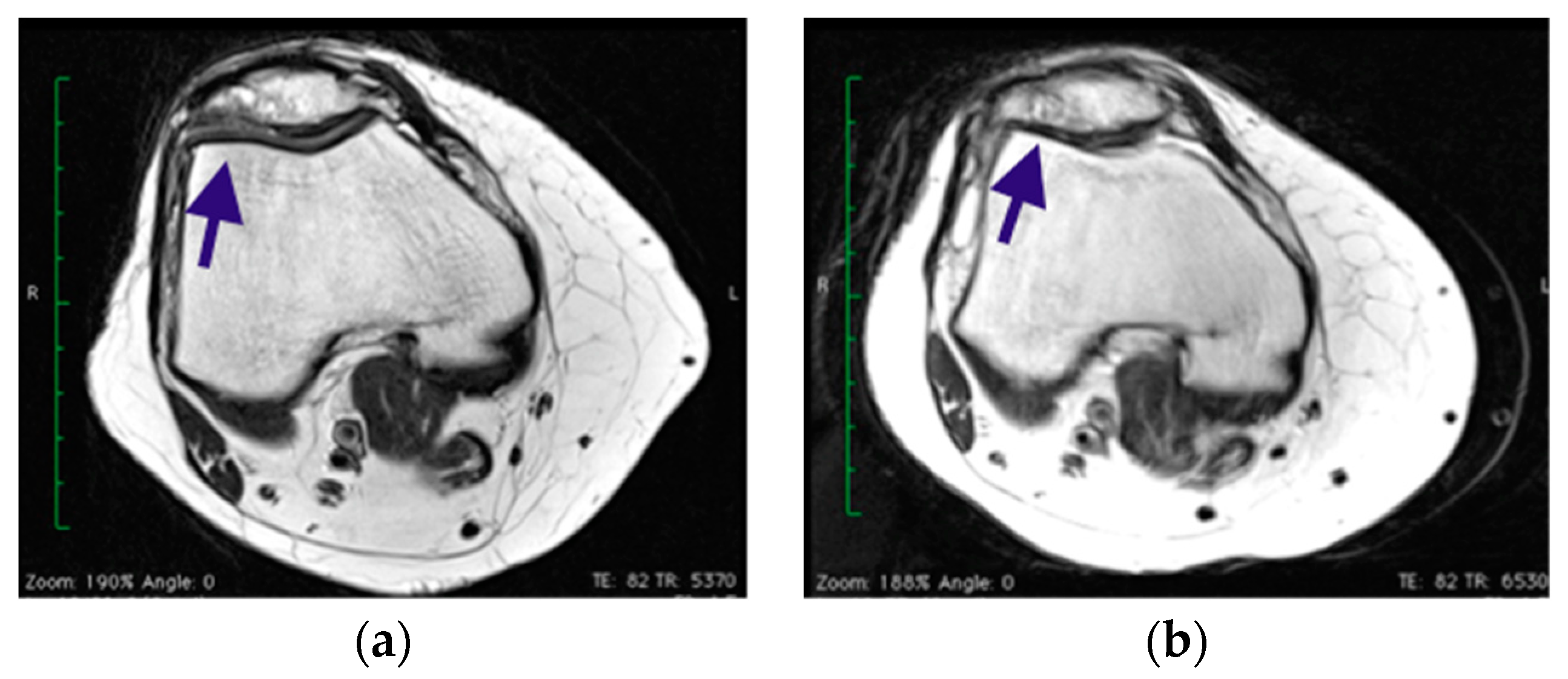 Healthcare 11 02995 g005