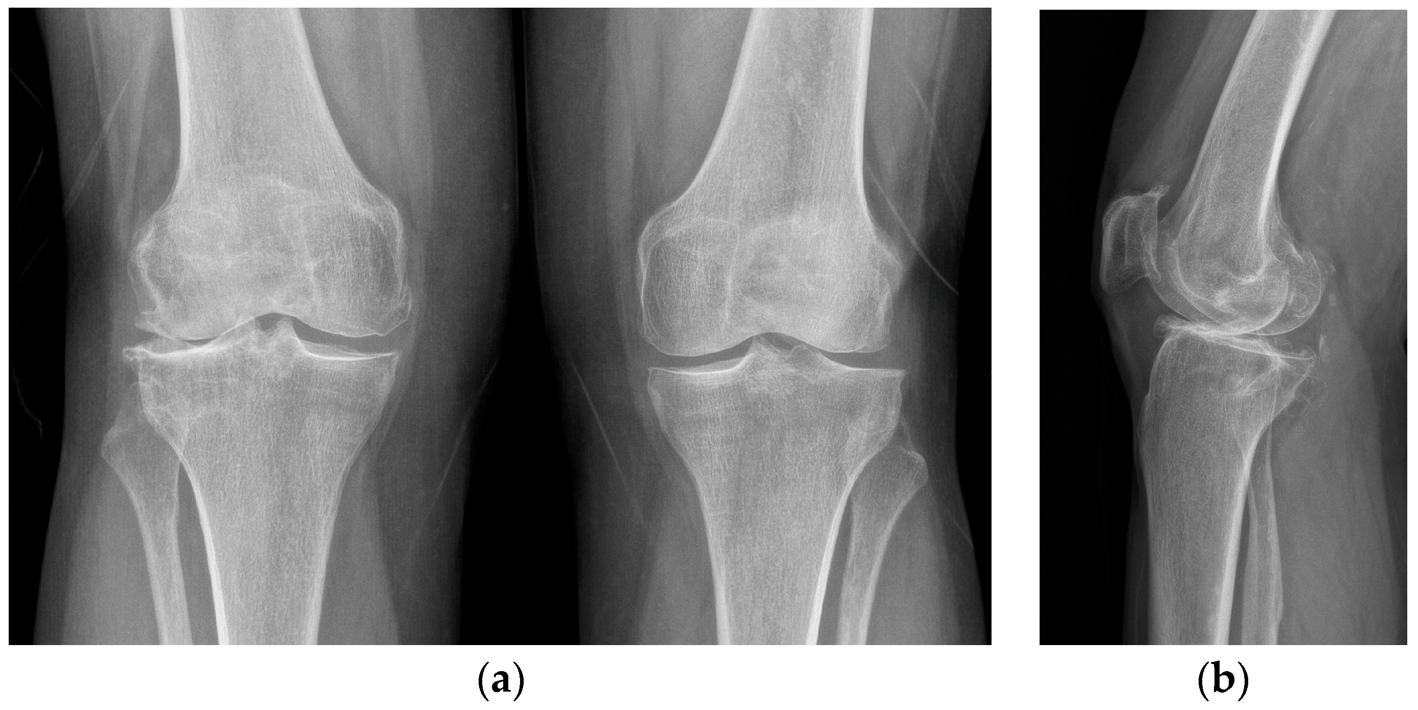 Healthcare 11 02999 g002 Healthcare 11 02999 g002