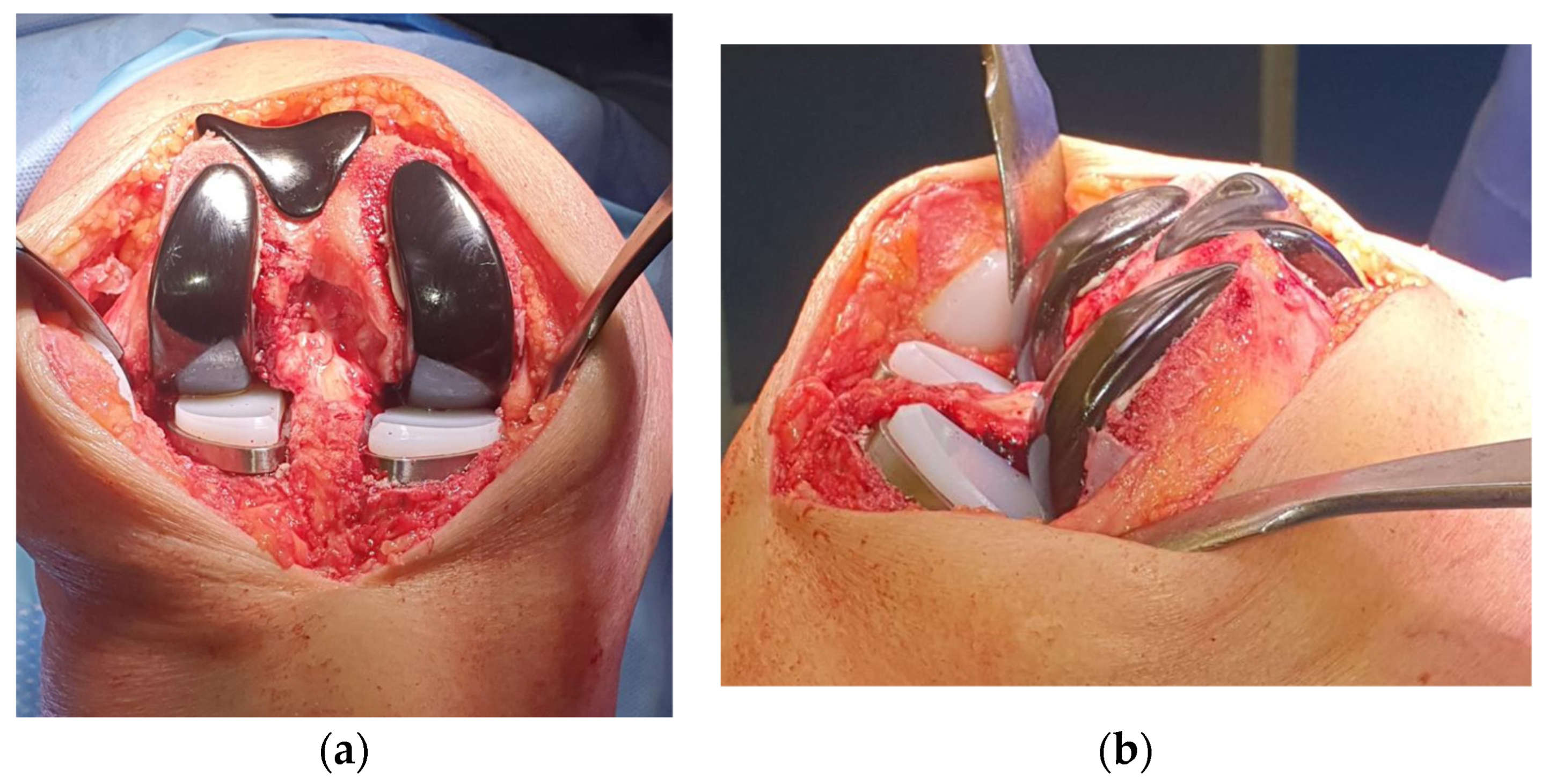 Healthcare 11 02999 g004 Healthcare 11 02999 g004