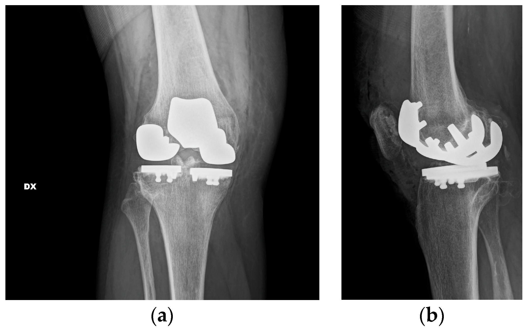 Healthcare 11 02999 g005 Healthcare 11 02999 g005