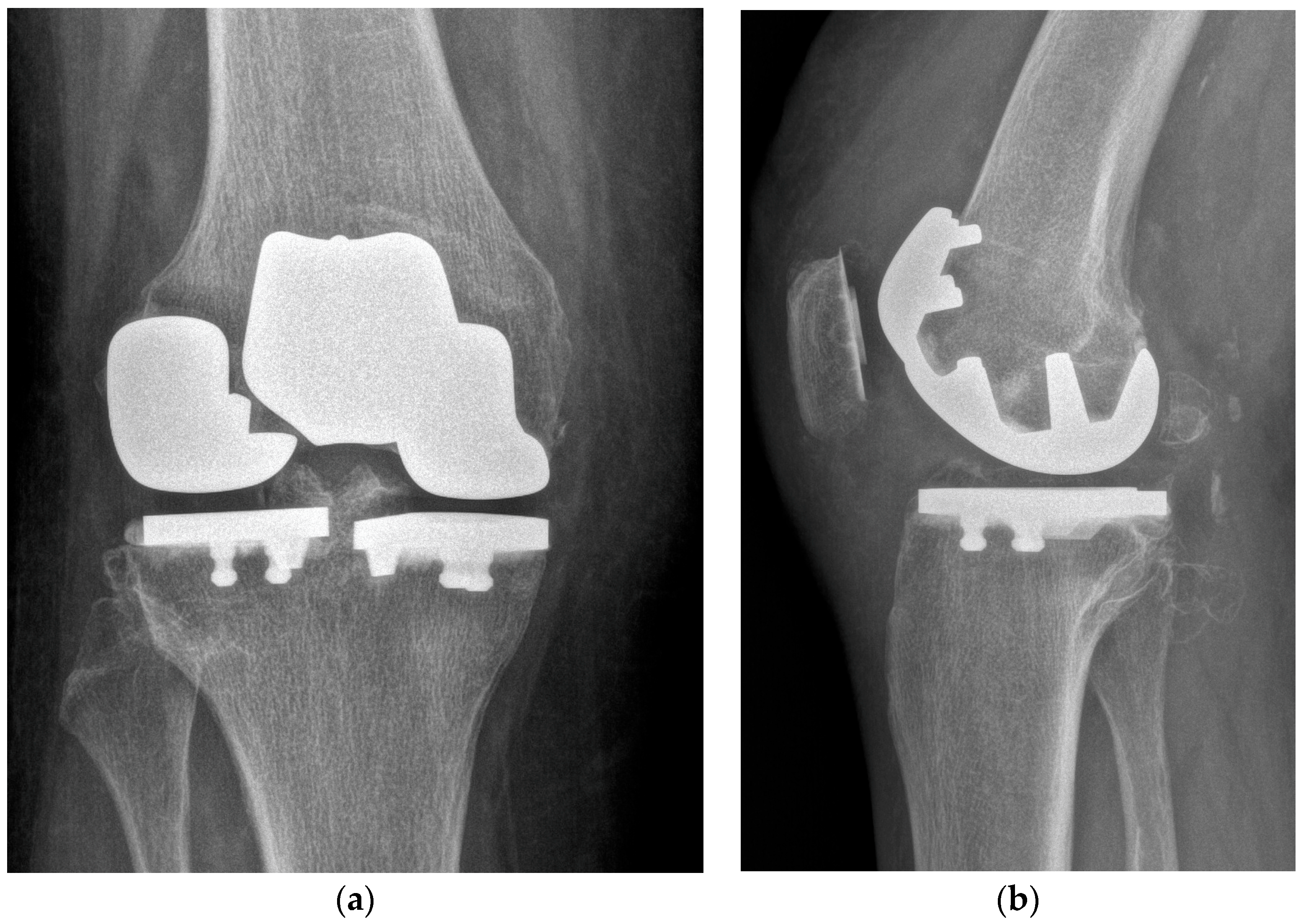 Healthcare 11 02999 g006 Healthcare 11 02999 g006