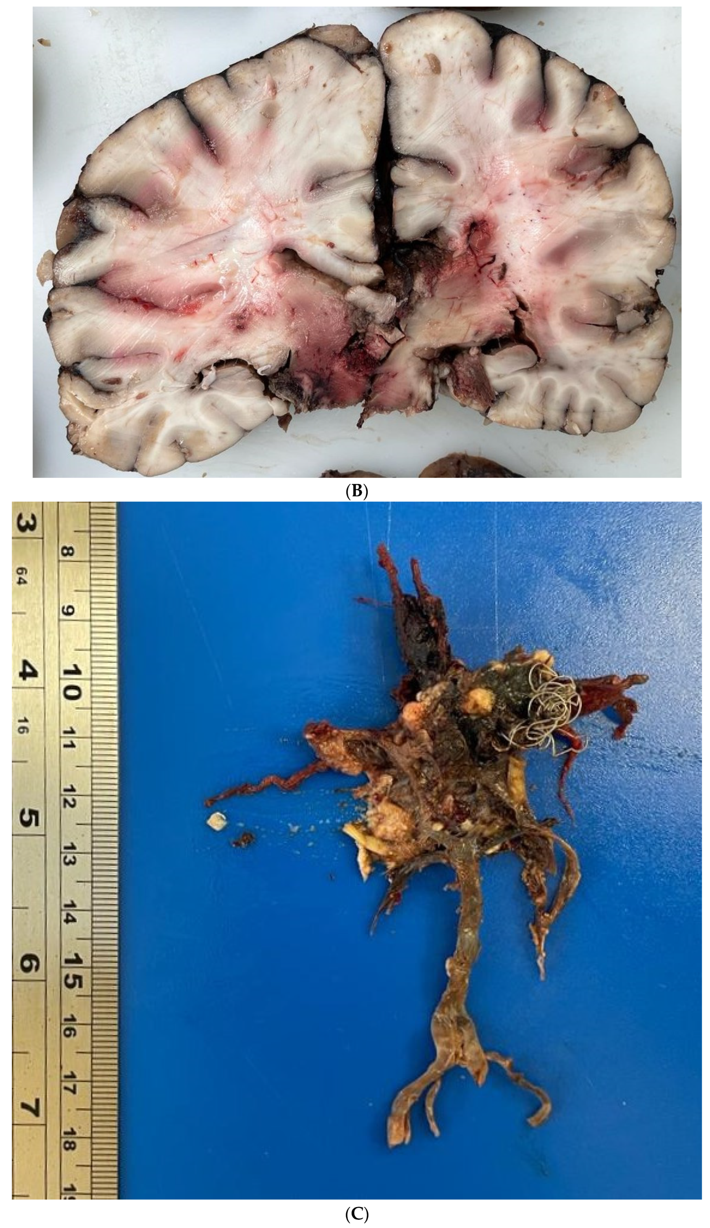 Healthcare 12 00192 g002b