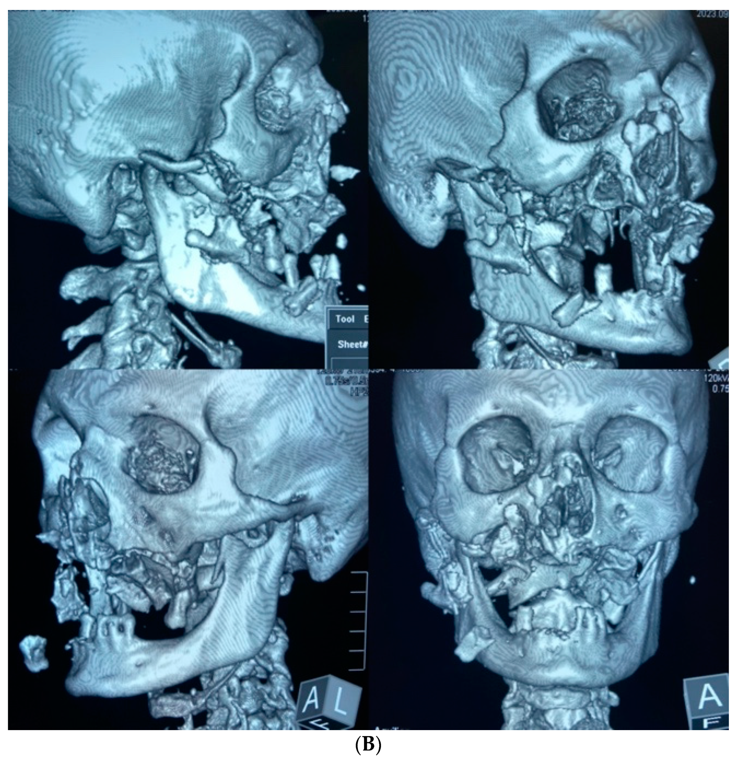 Healthcare 12 00542 g001b