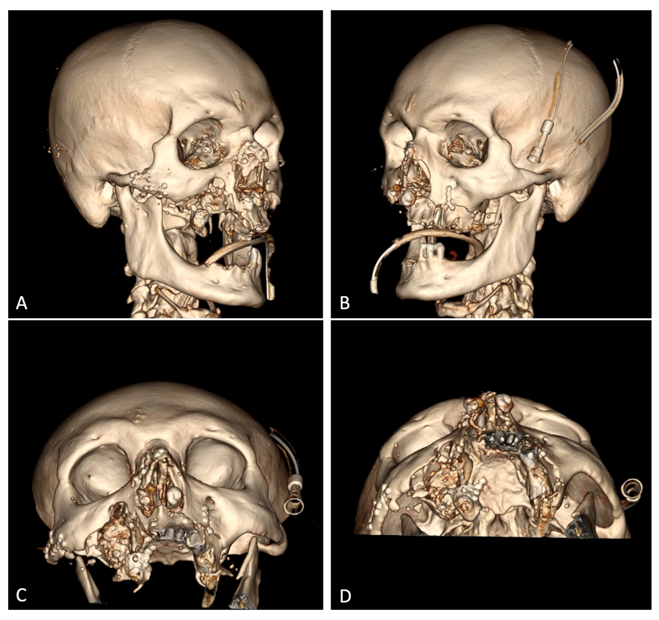 Healthcare 12 00542 g004