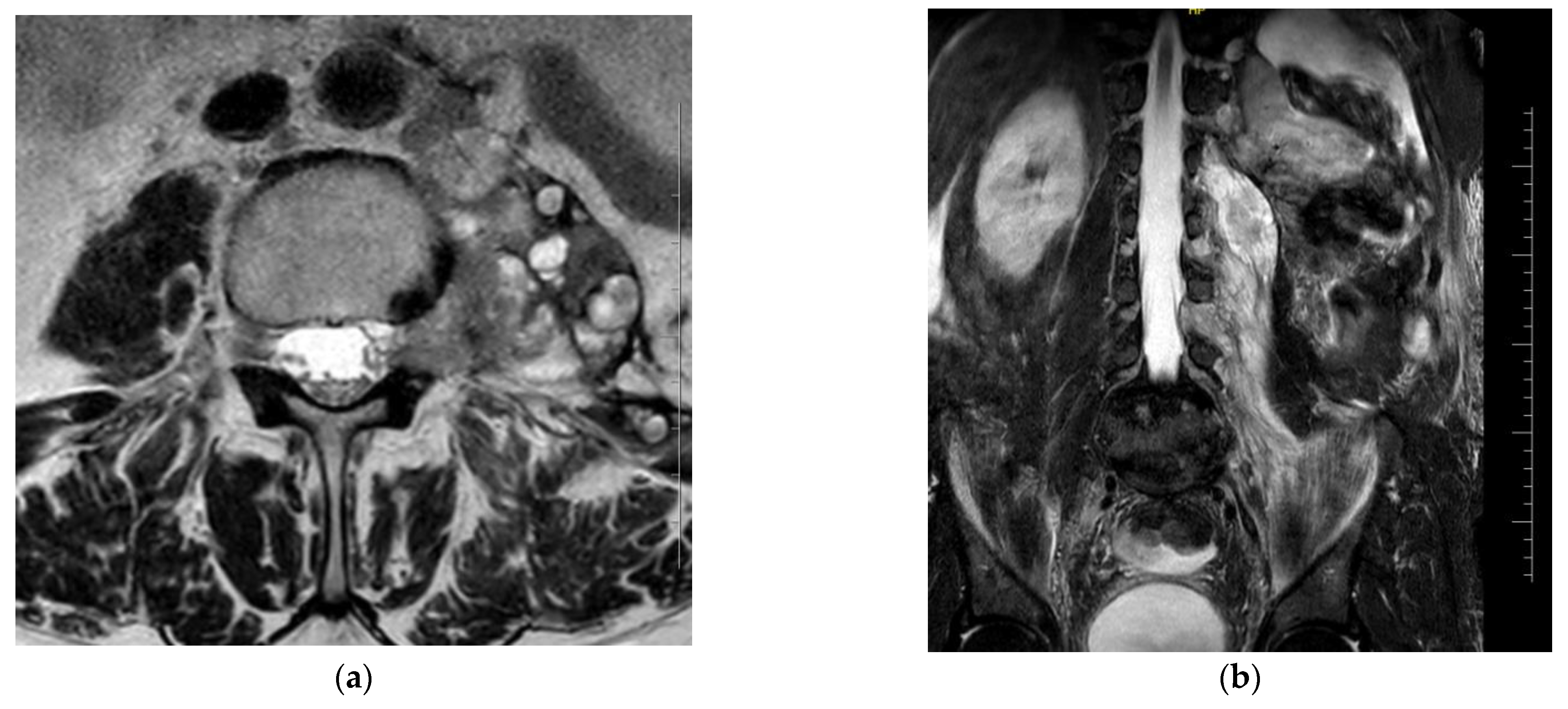 Healthcare 12 00856 g001