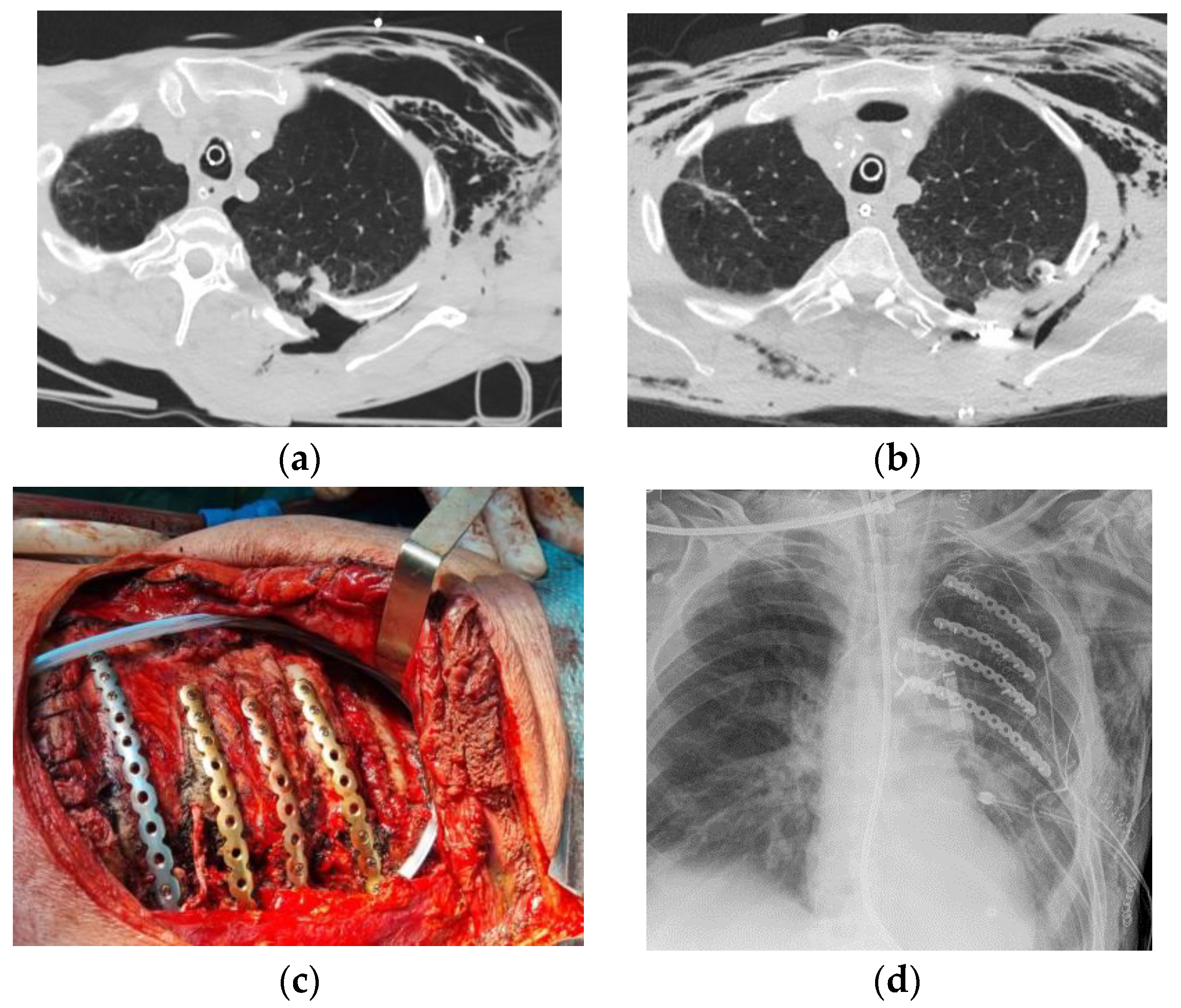 Healthcare 12 01147 g001