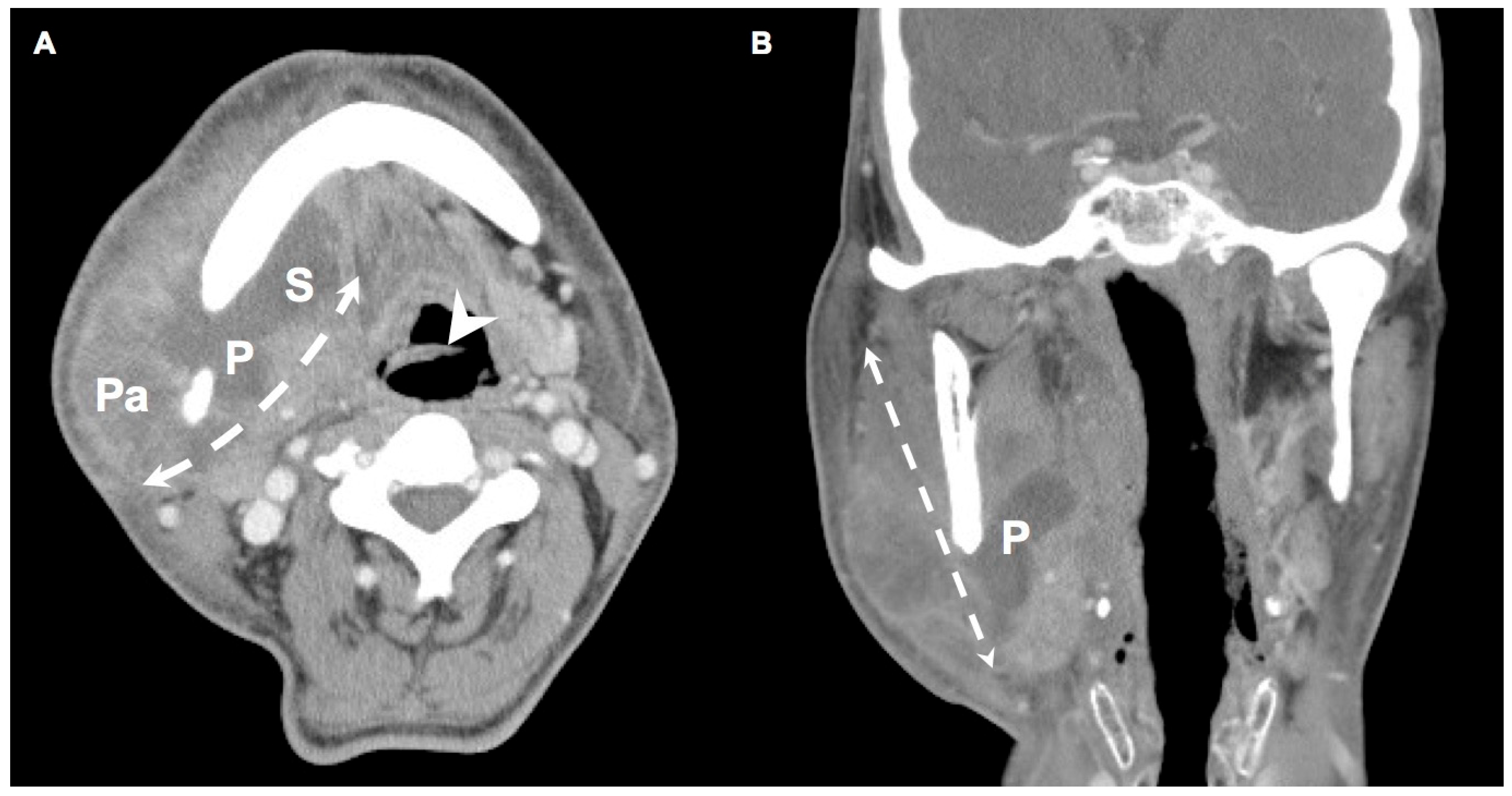 Healthcare 12 01383 g001