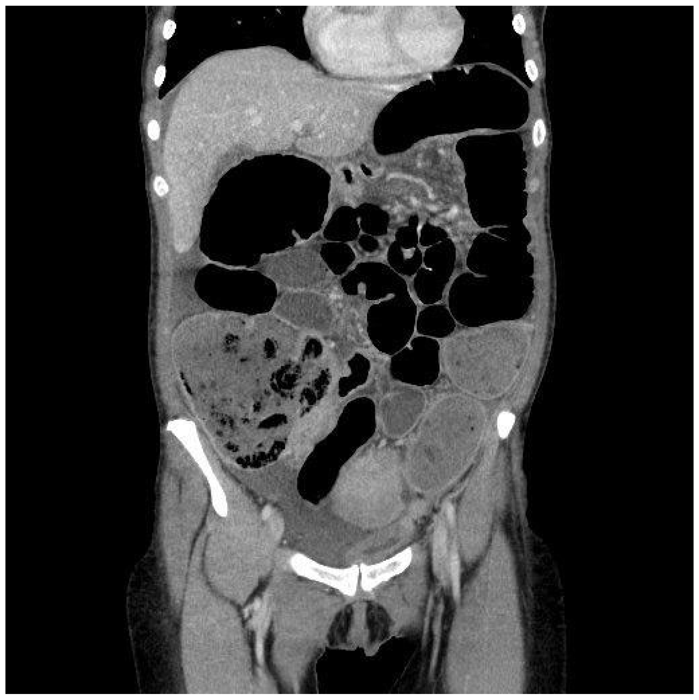 Healthcare 13 00485 g001