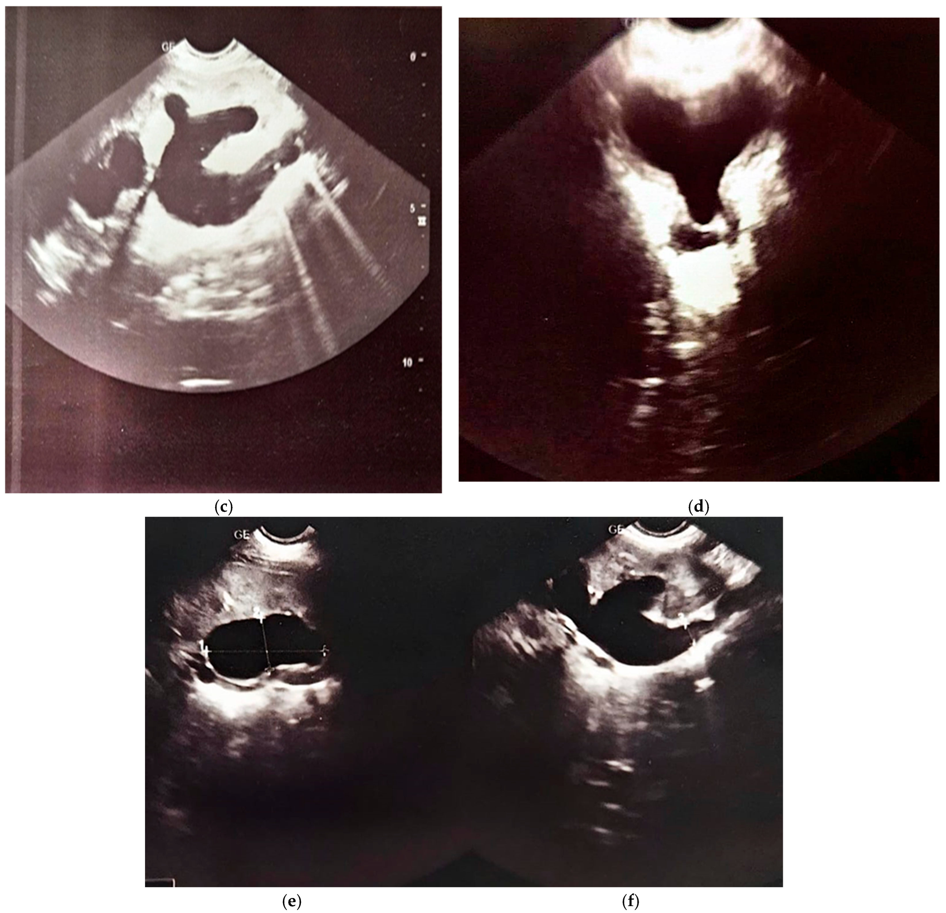 Healthcare 13 00998 g008b