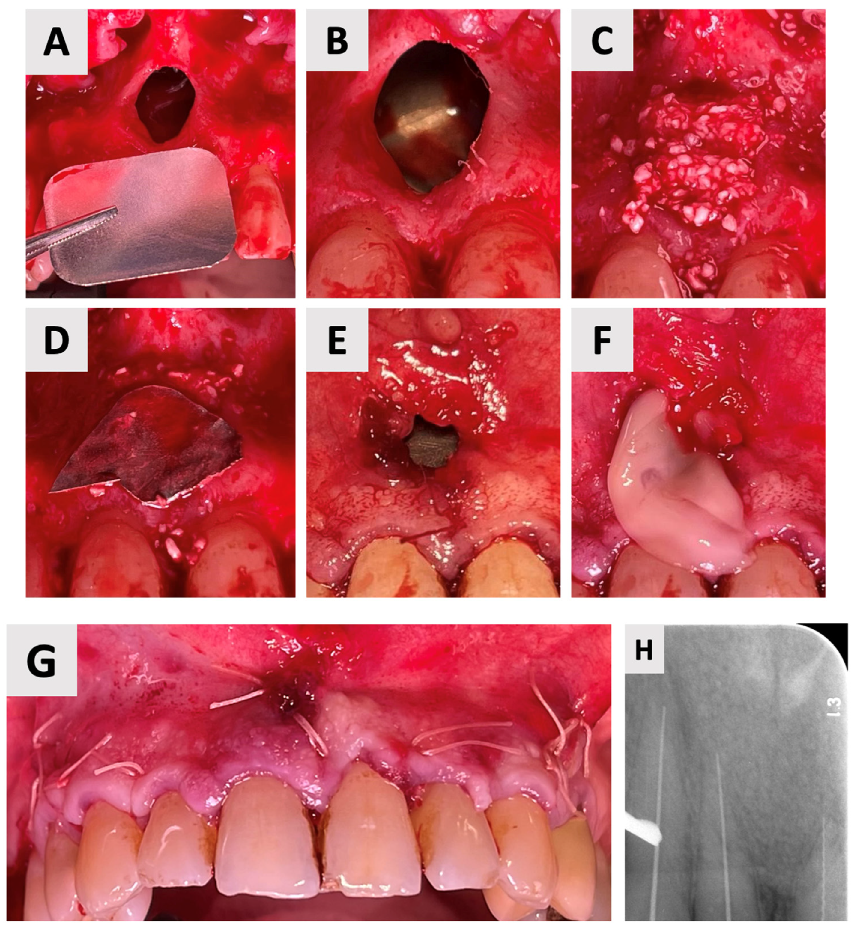 Healthcare 13 01068 g004 Healthcare 13 01068 g004