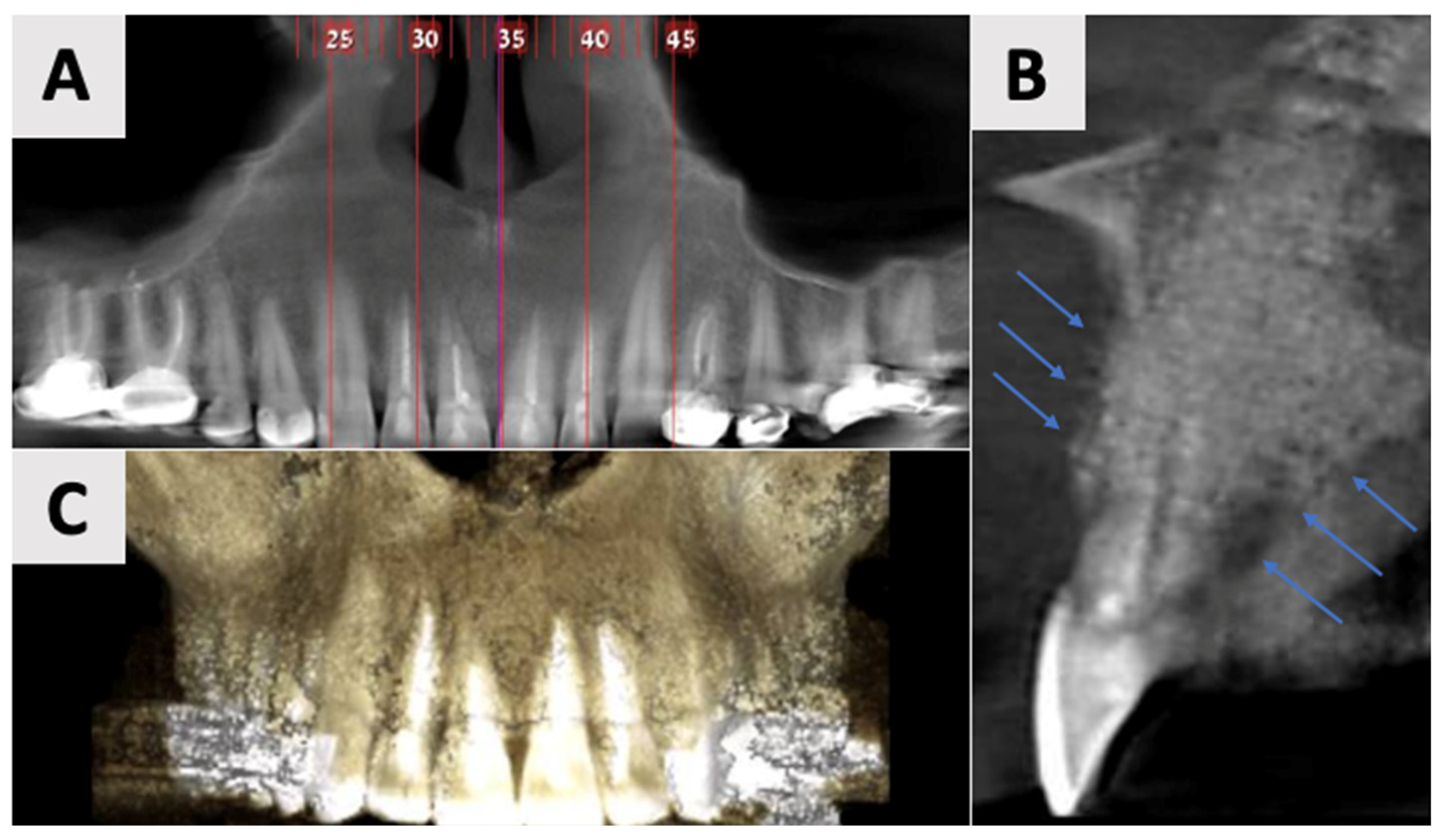 Healthcare 13 01068 g006 Healthcare 13 01068 g006