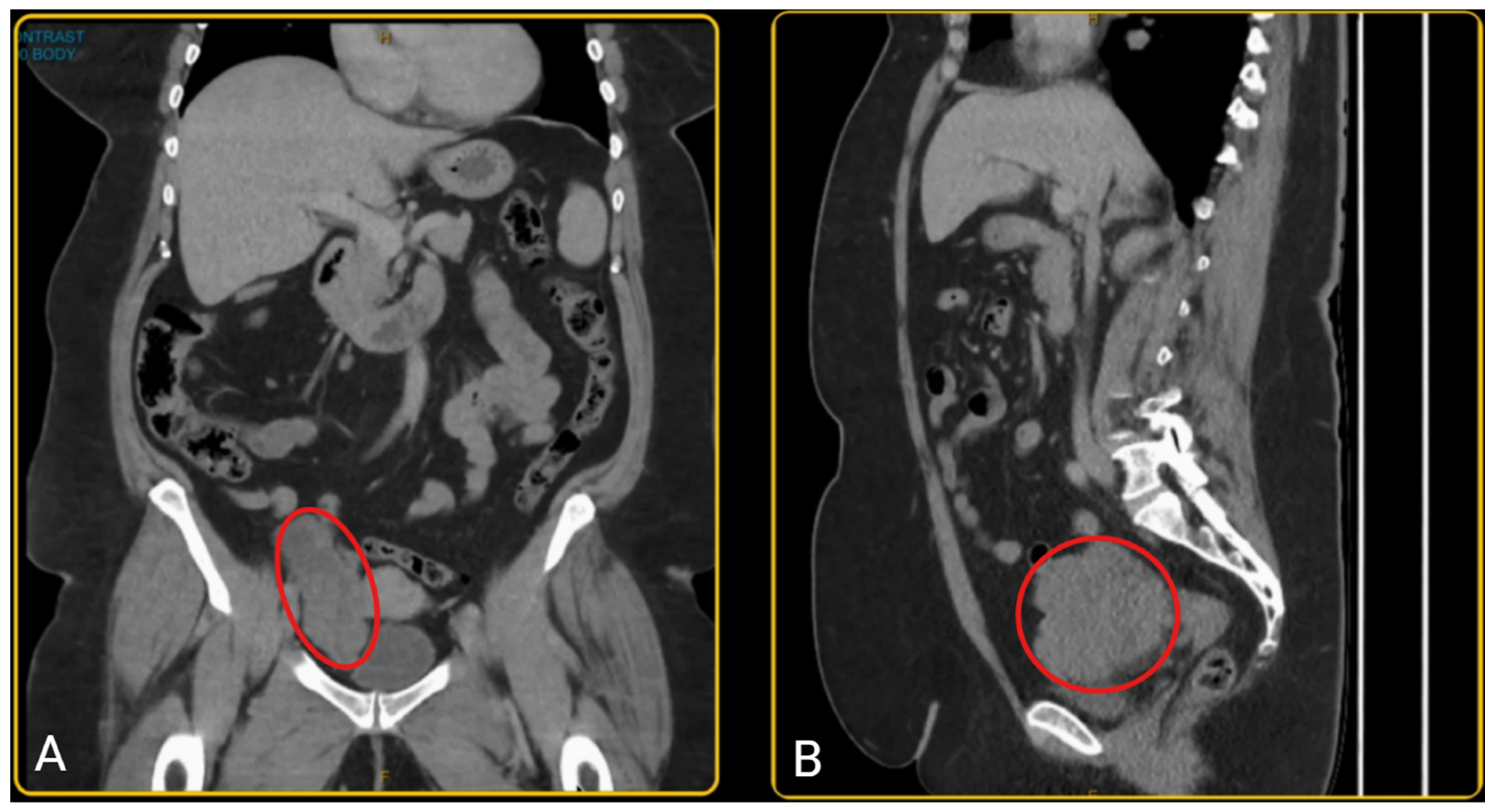 Healthcare 13 01367 g001