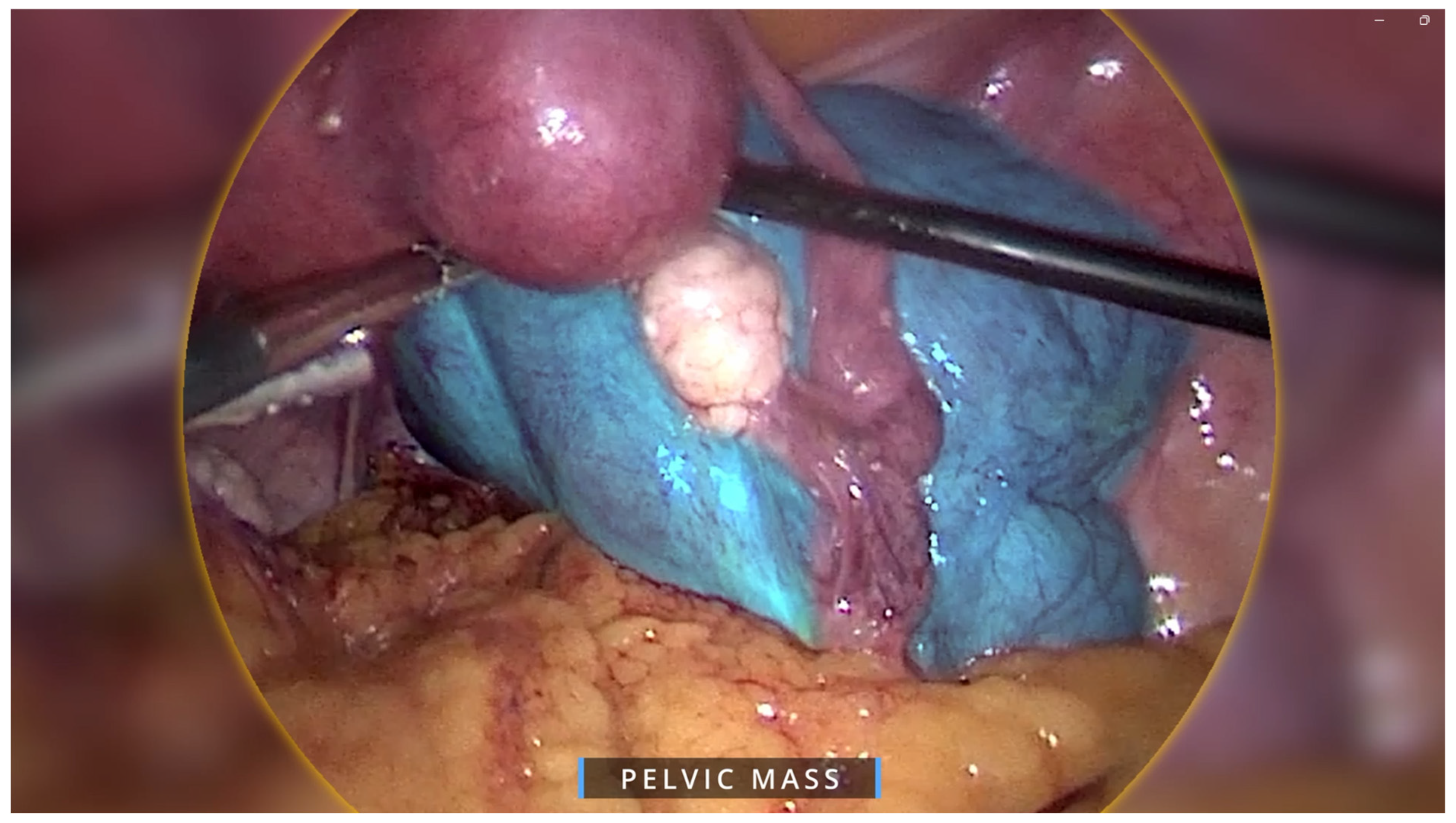 Healthcare 13 01367 g002