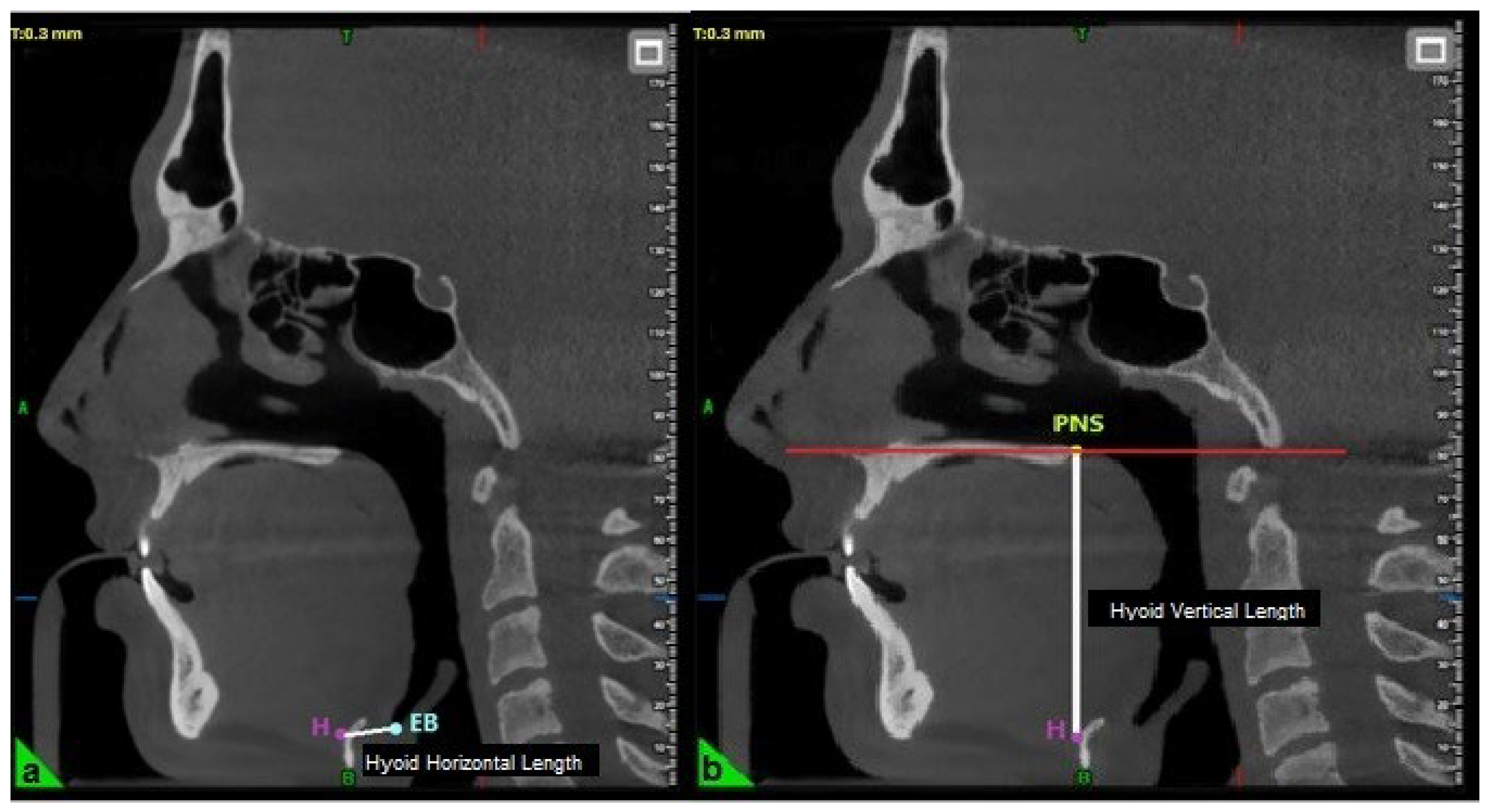 Healthcare 13 02423 g002