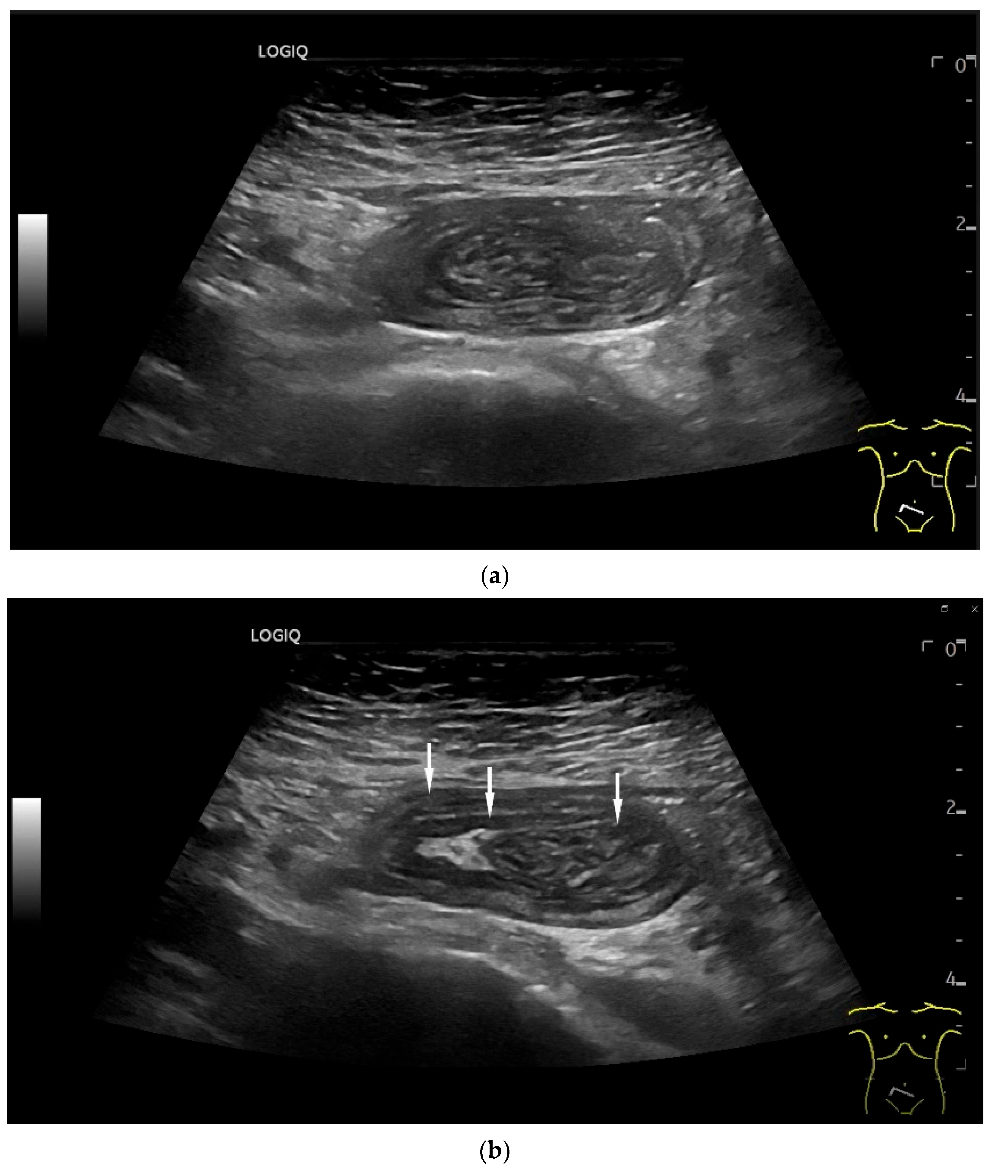 Healthcare 13 02776 g003