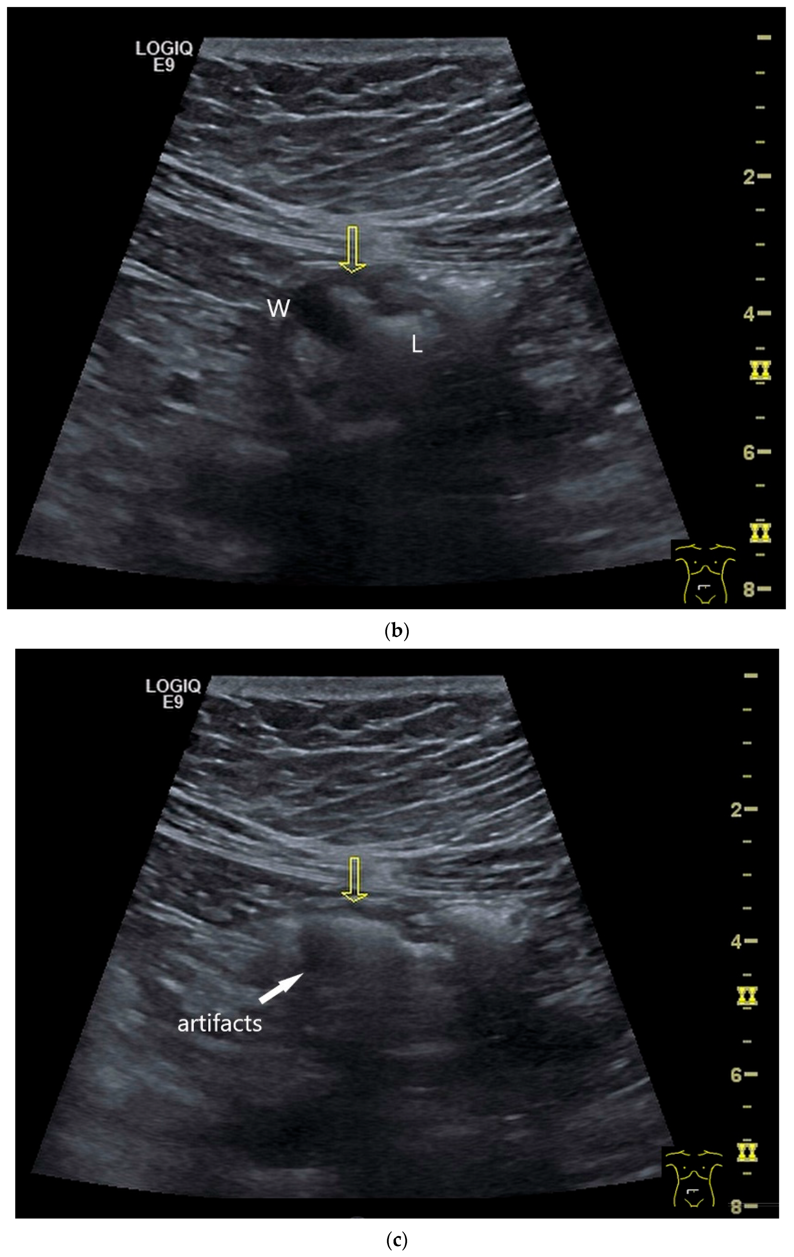 Healthcare 13 02776 g004b