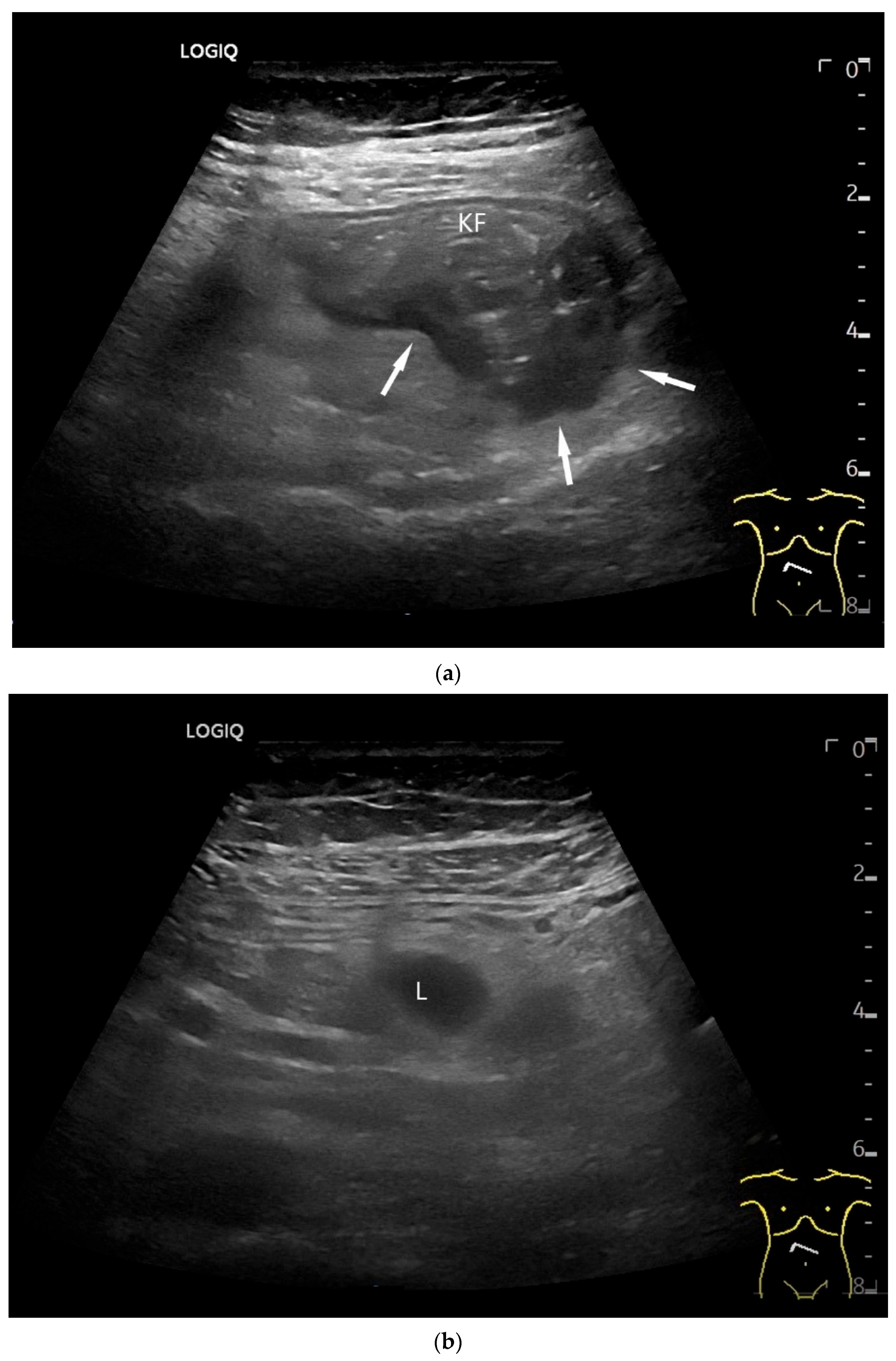 Healthcare 13 02776 g006