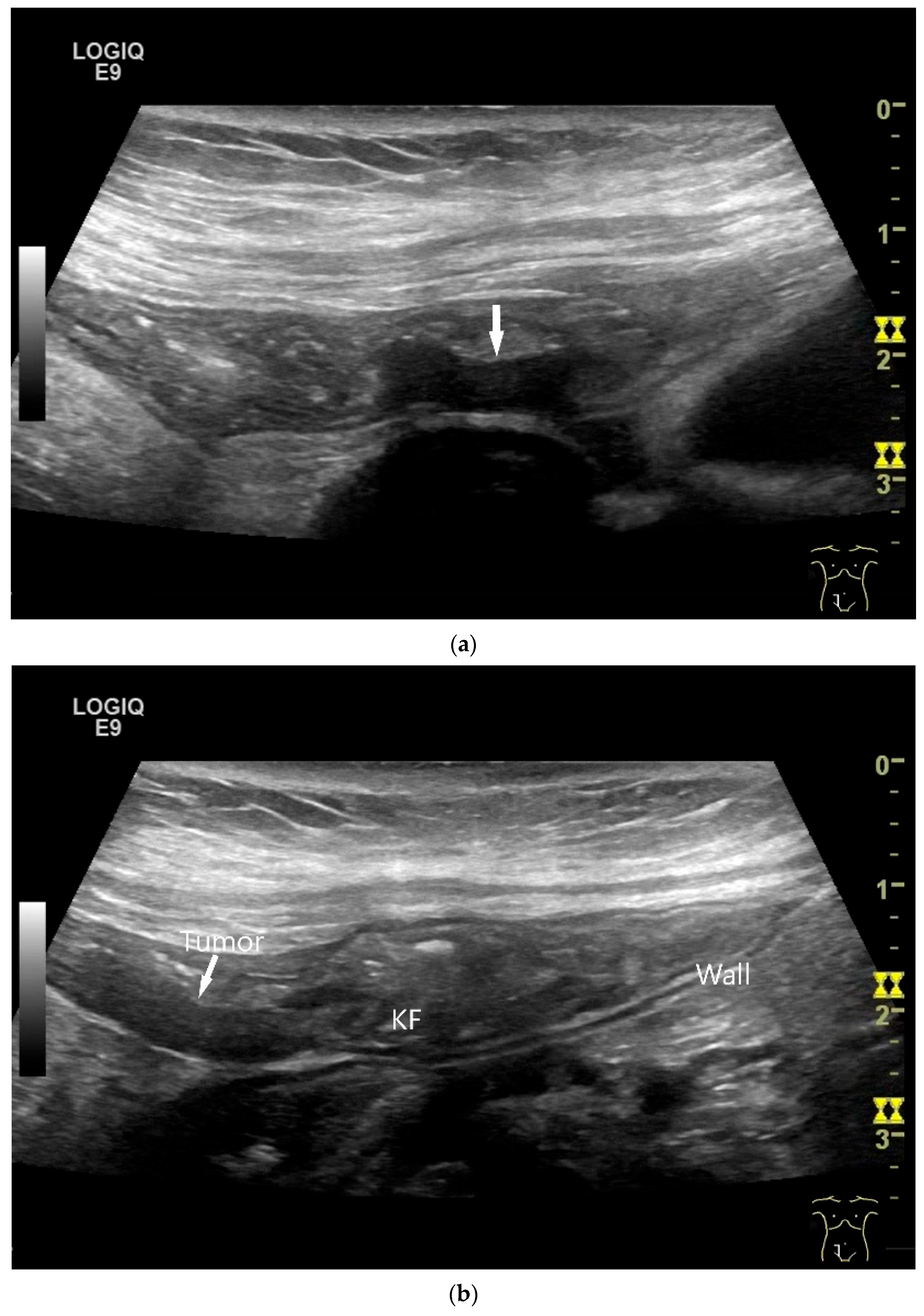 Healthcare 13 02776 g008a