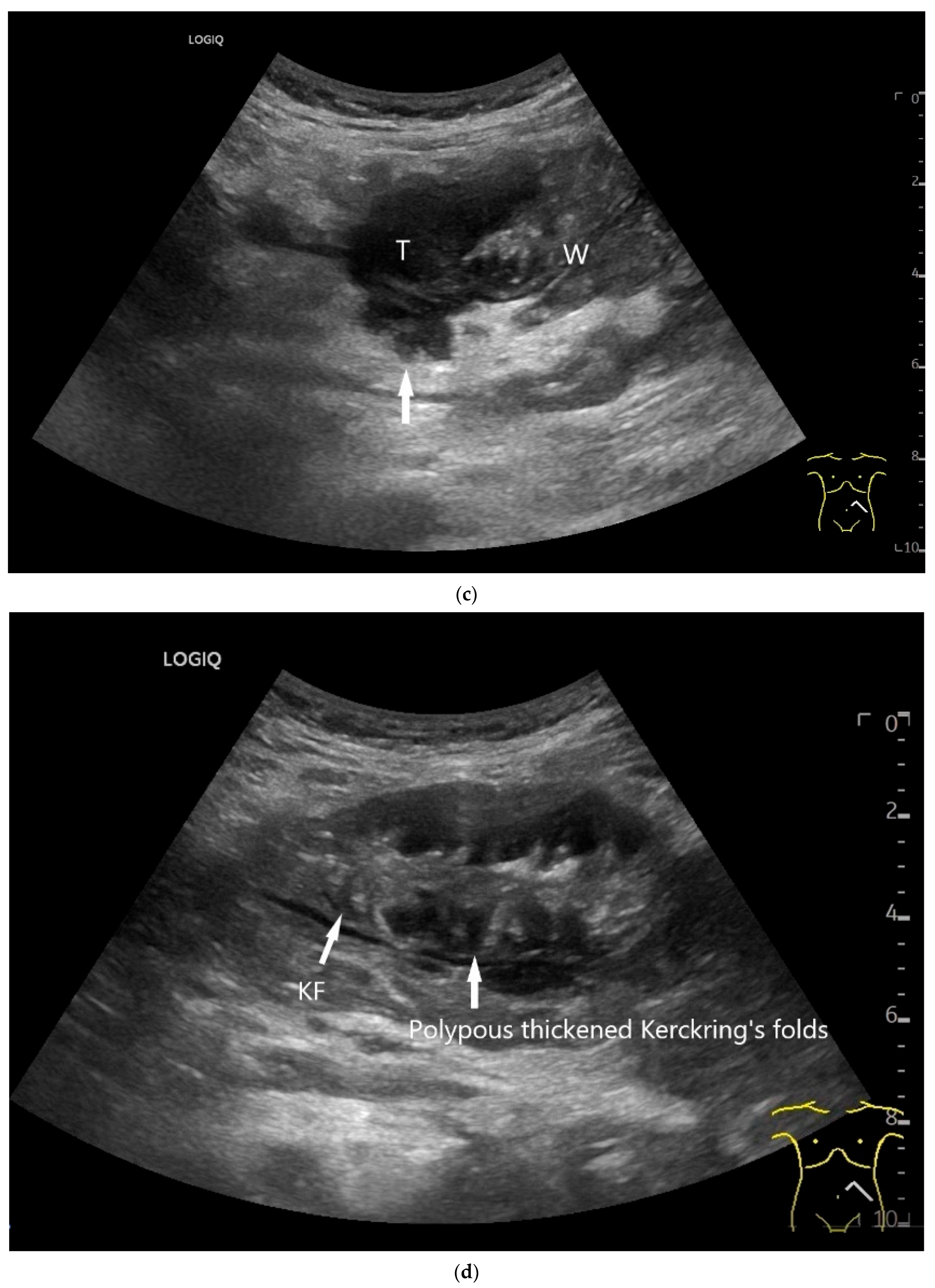 Healthcare 13 02776 g009b