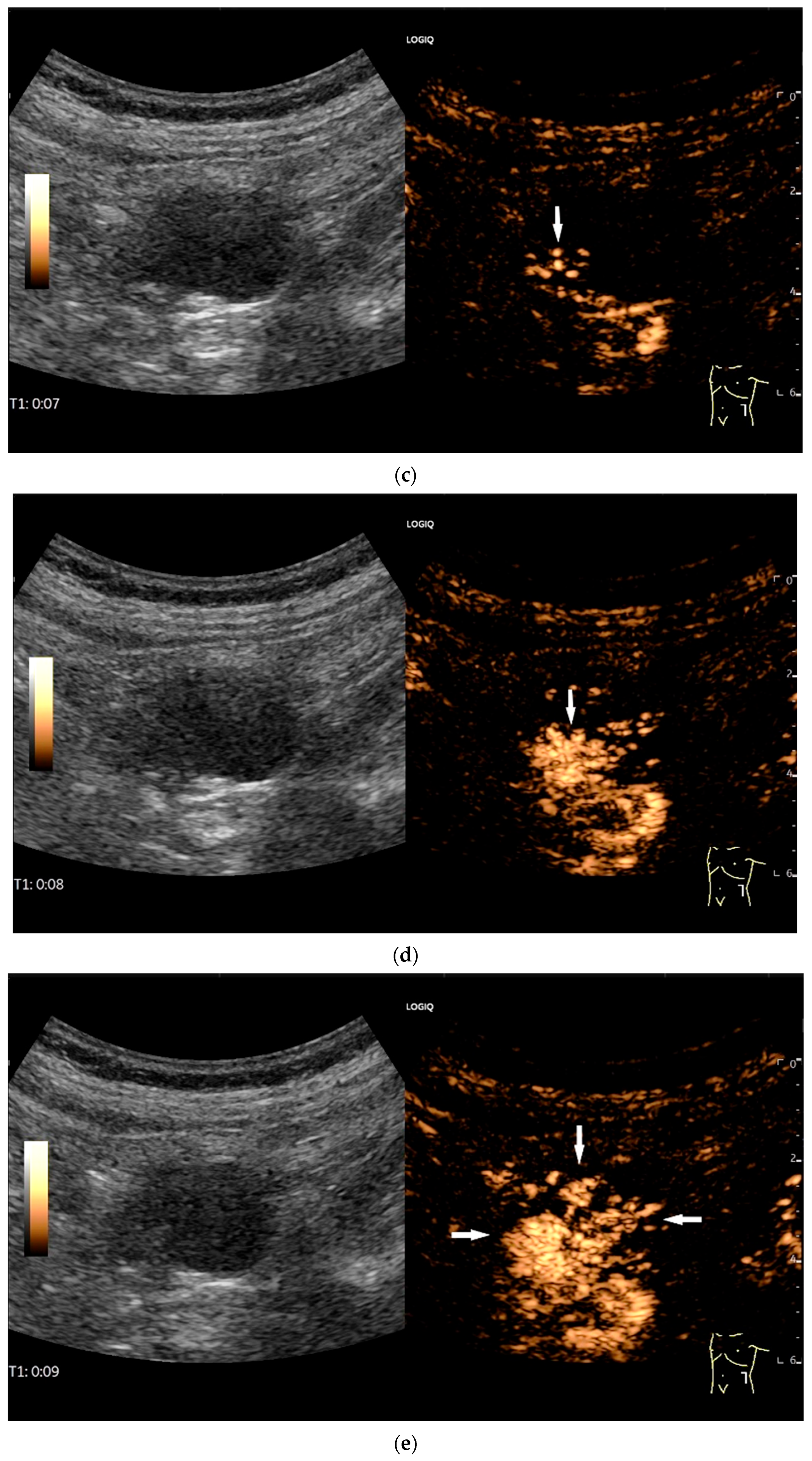 Healthcare 13 02776 g011b