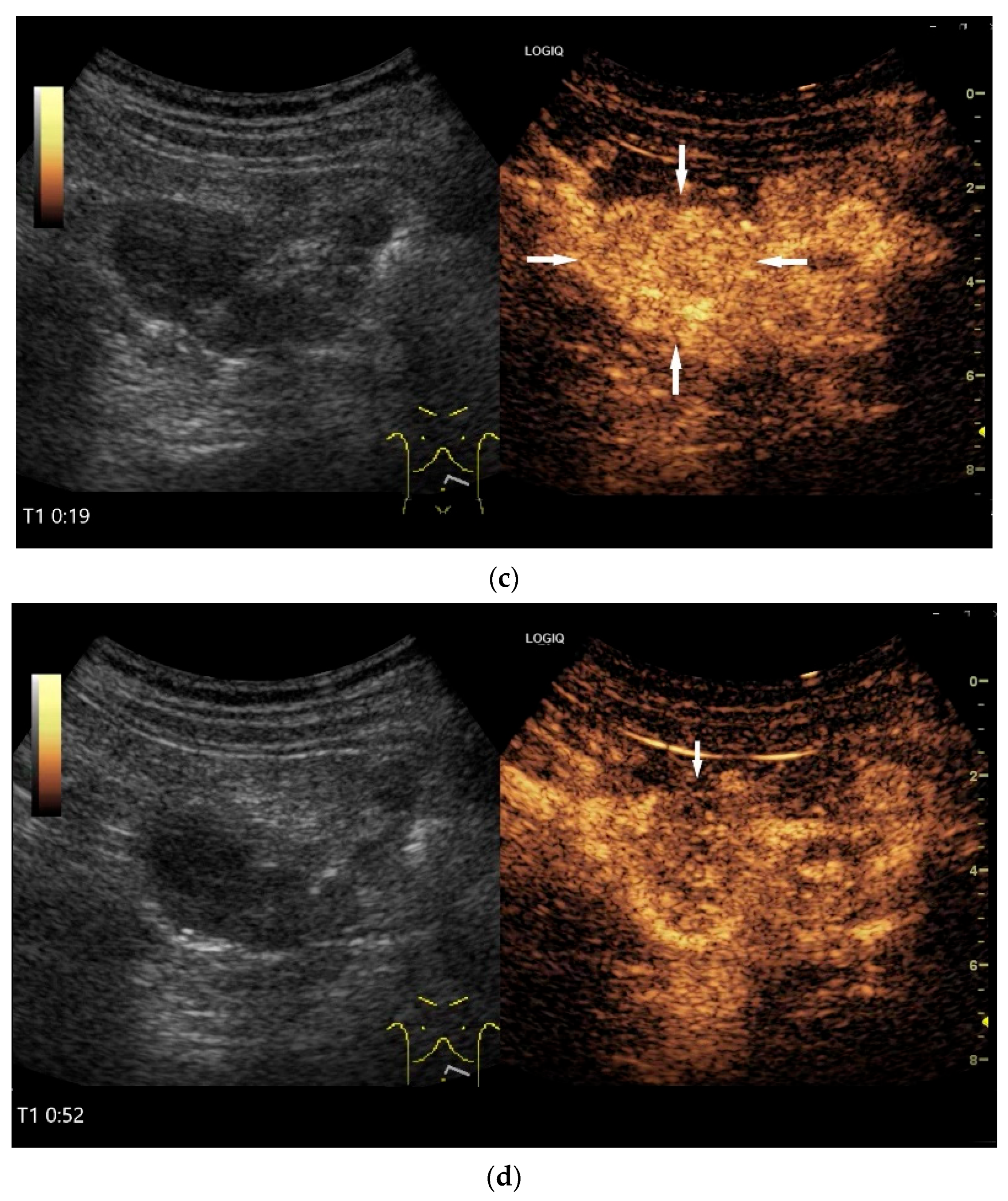 Healthcare 13 02776 g012b