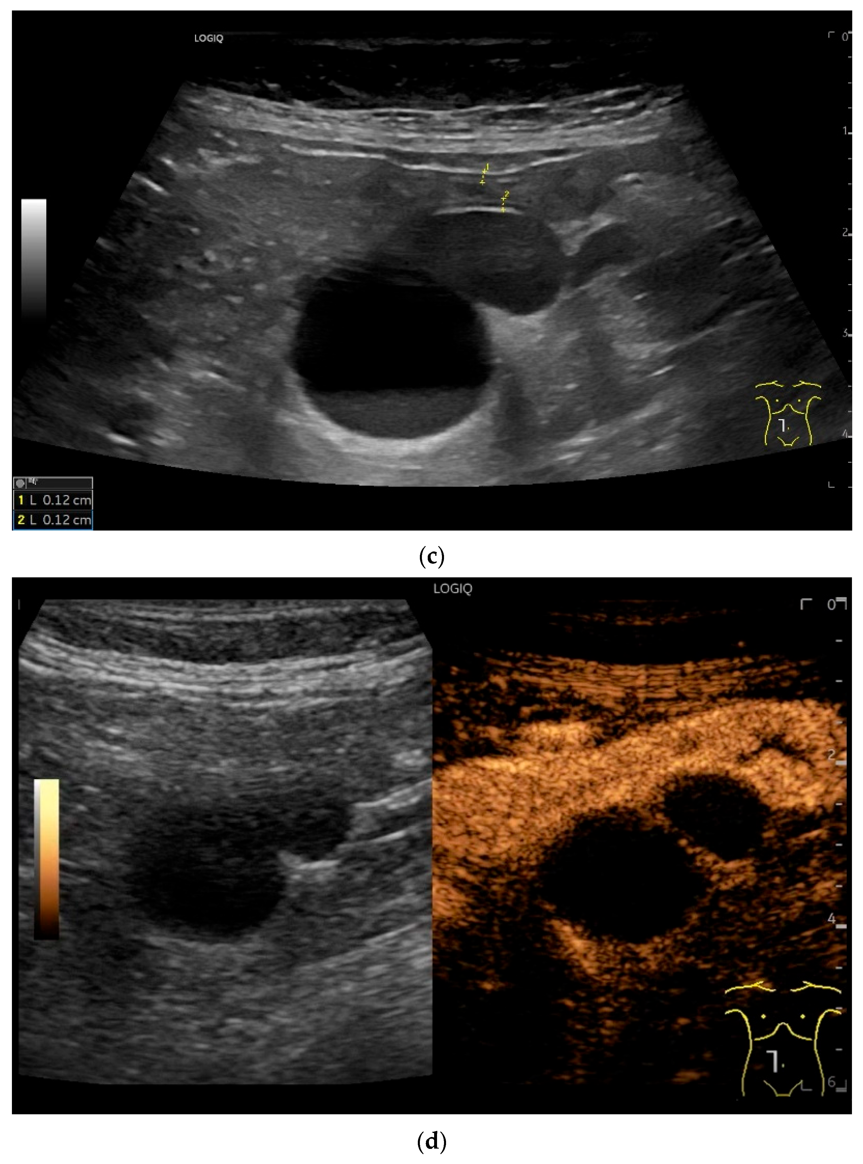 Healthcare 13 02776 g015b