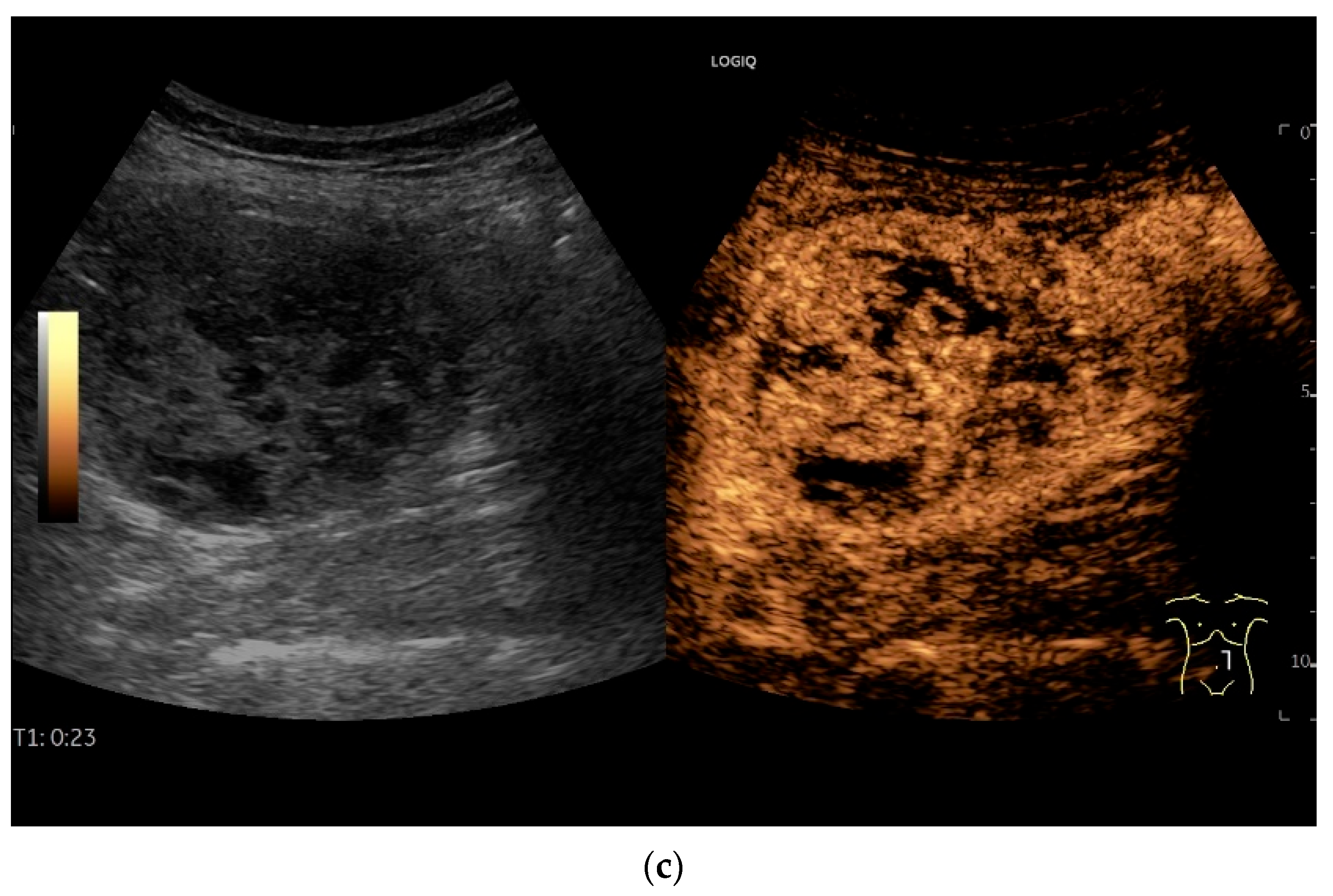 Healthcare 13 02776 g017b