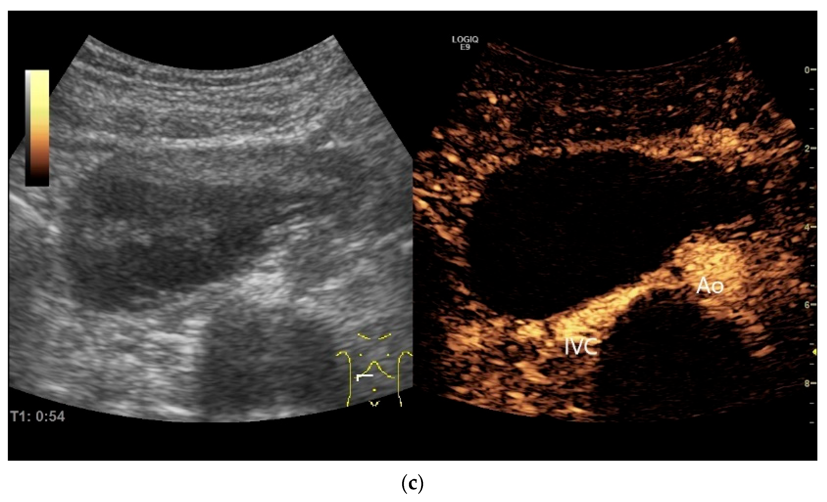 Healthcare 13 02776 g021b