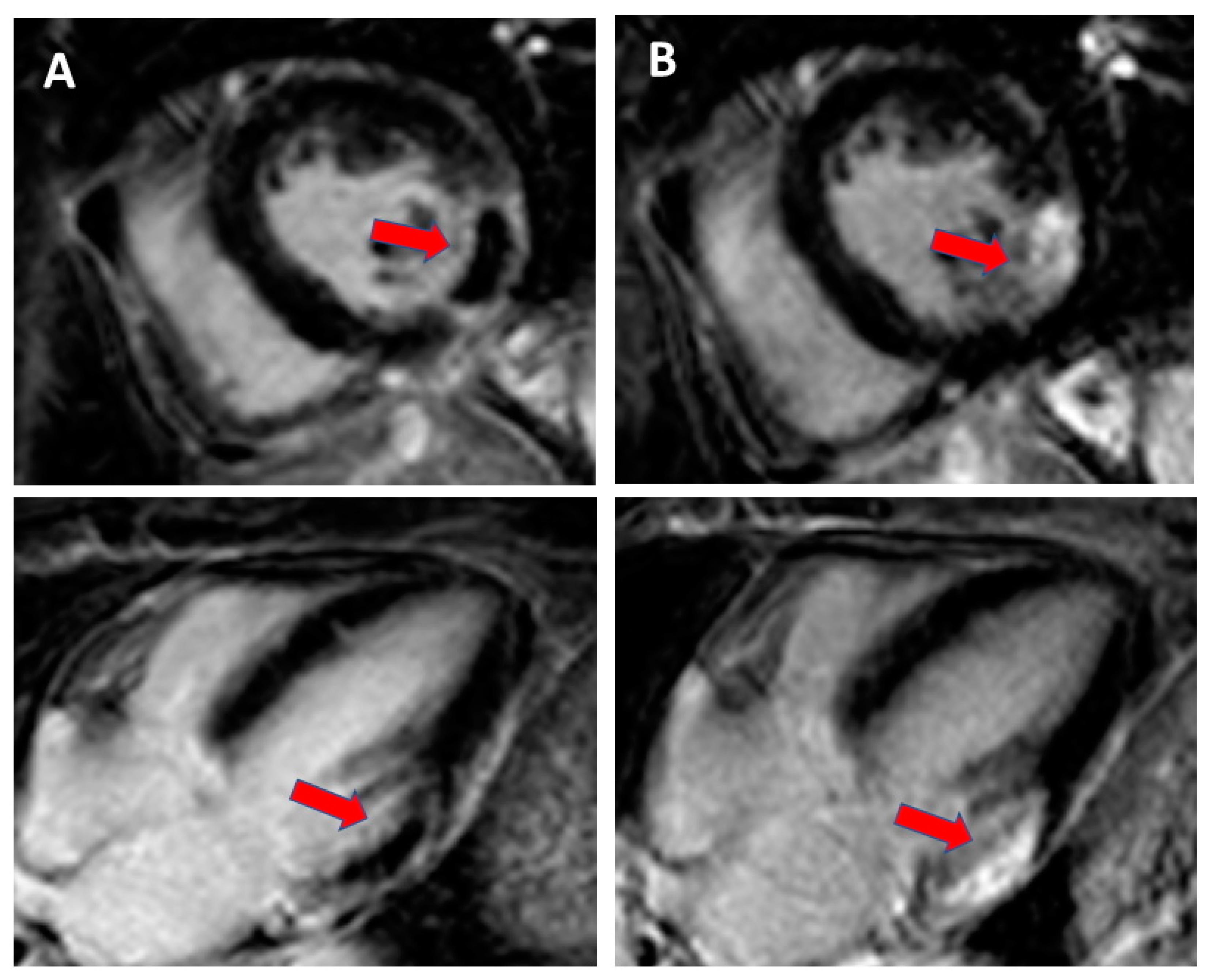 Hearts 01 00017 g003 Hearts 01 00017 g003