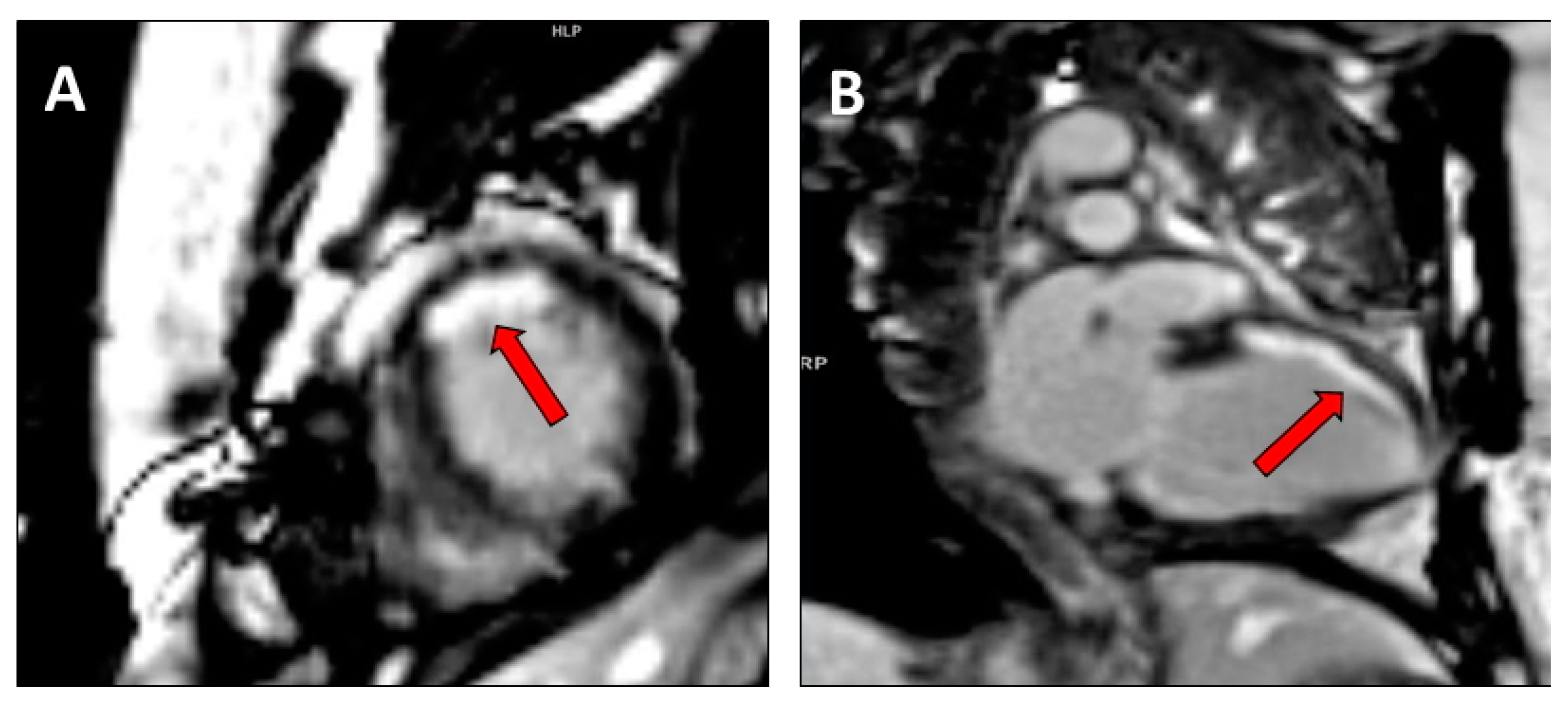 Hearts 01 00017 g004 Hearts 01 00017 g004