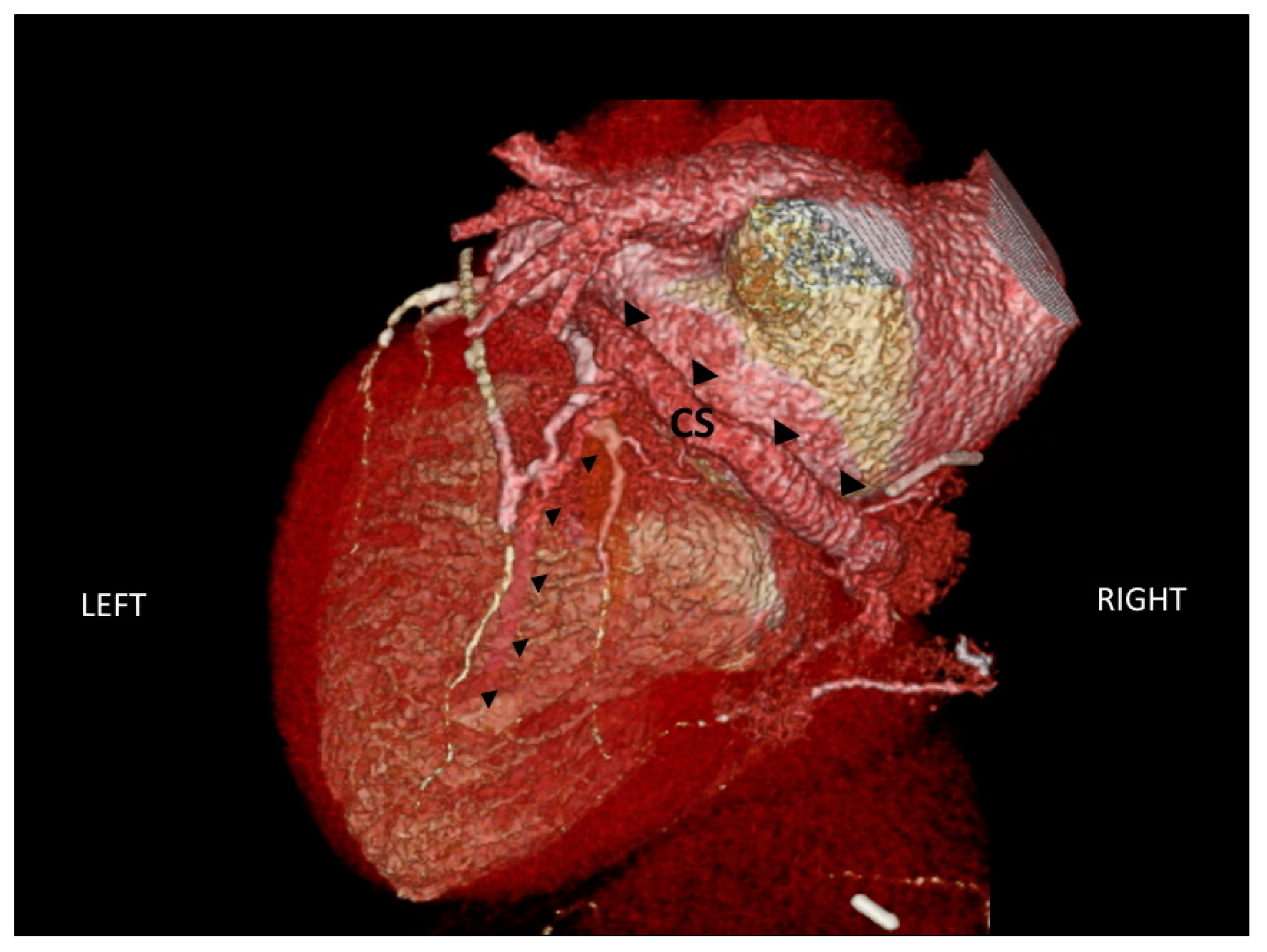 Hearts 01 00017 g005 Hearts 01 00017 g005