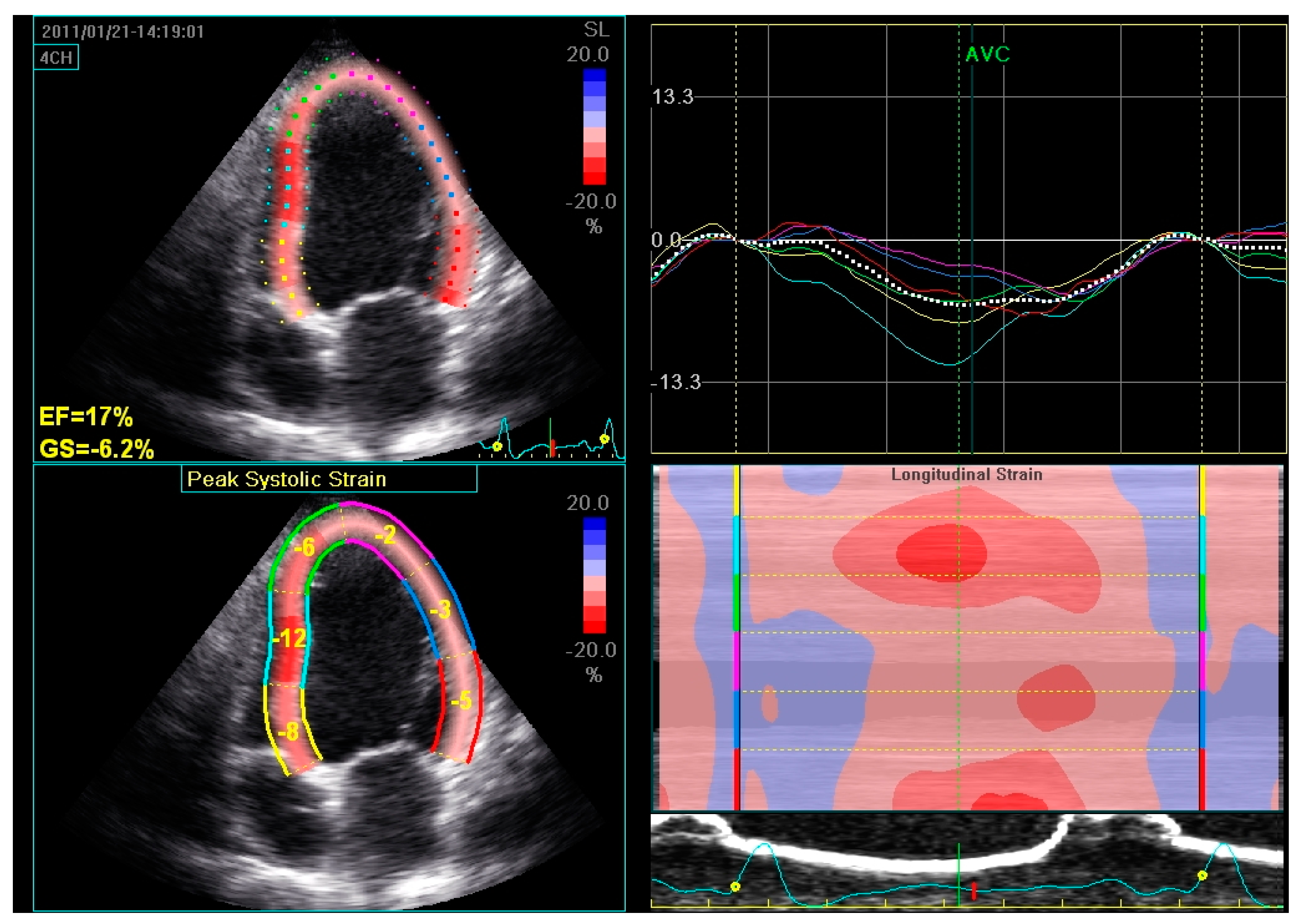 Hearts 01 00017 g006 Hearts 01 00017 g006