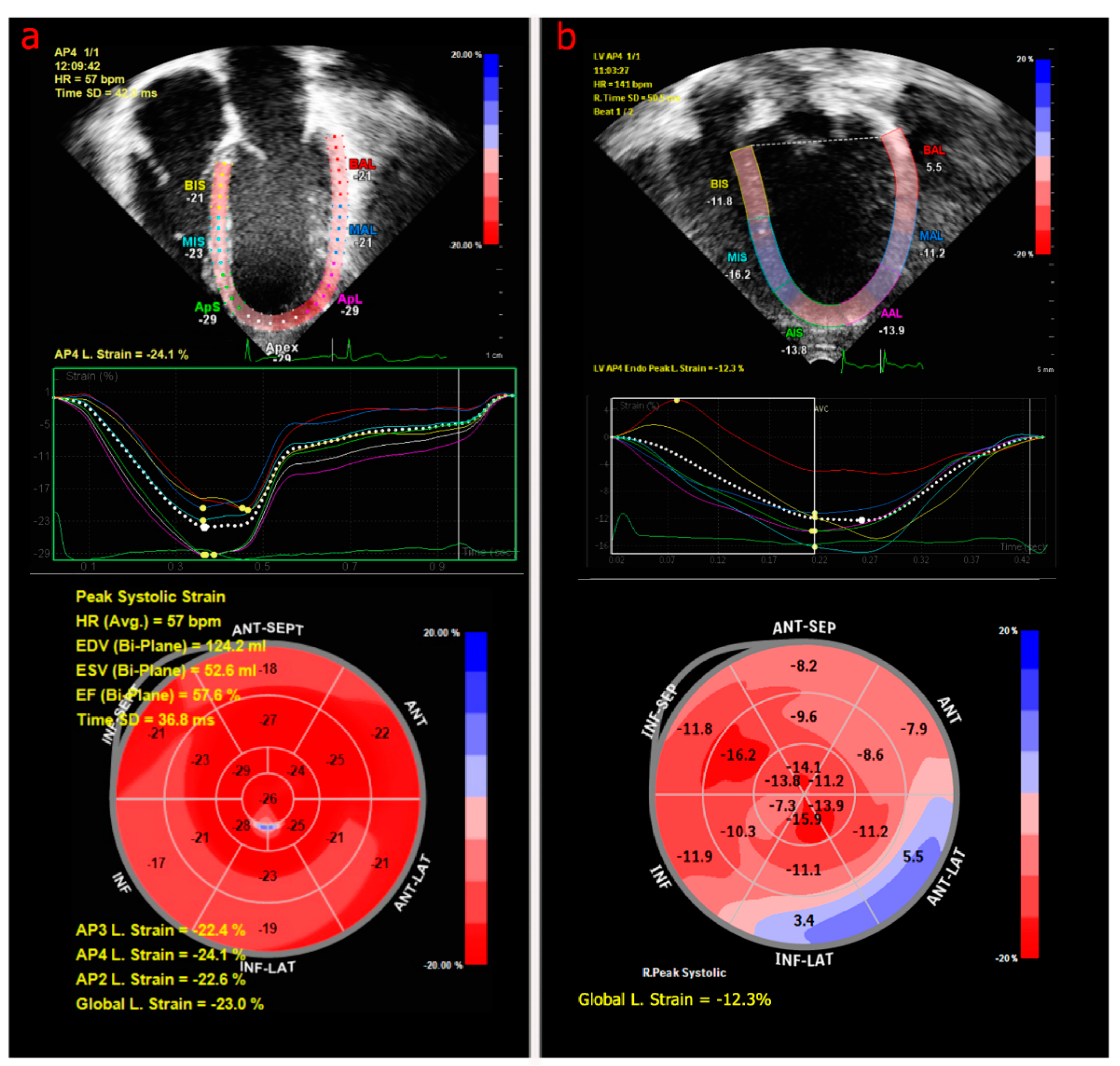 Hearts 02 00005 g001 Hearts 02 00005 g001