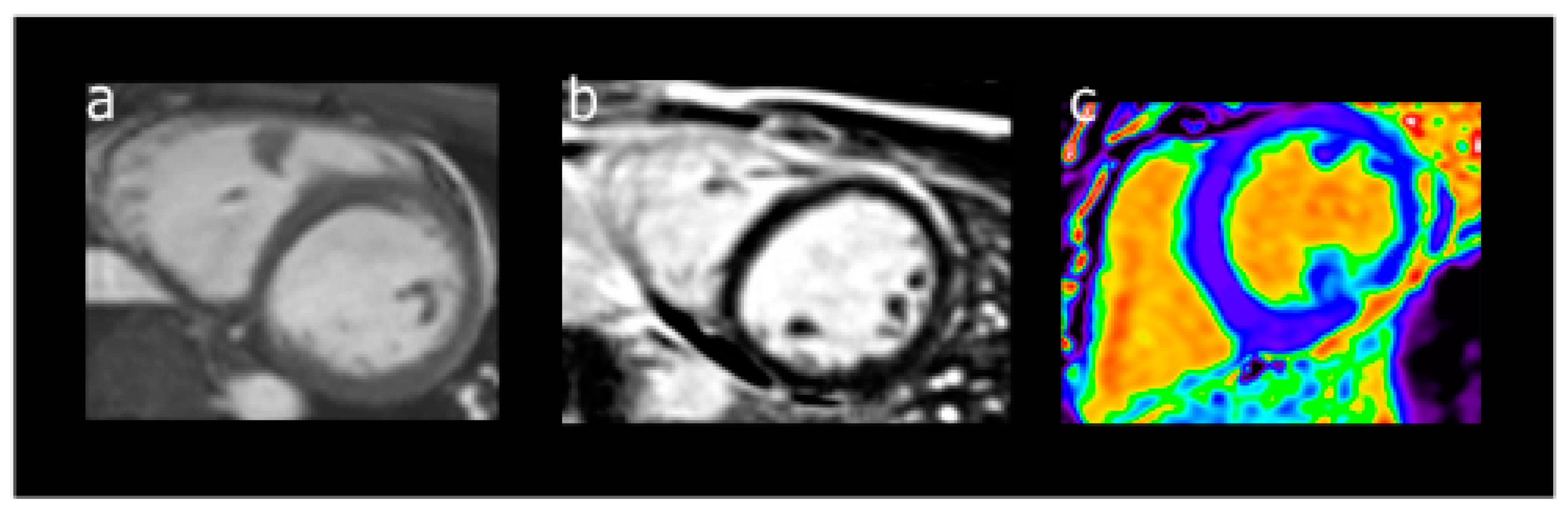 Hearts 02 00005 g002 Hearts 02 00005 g002