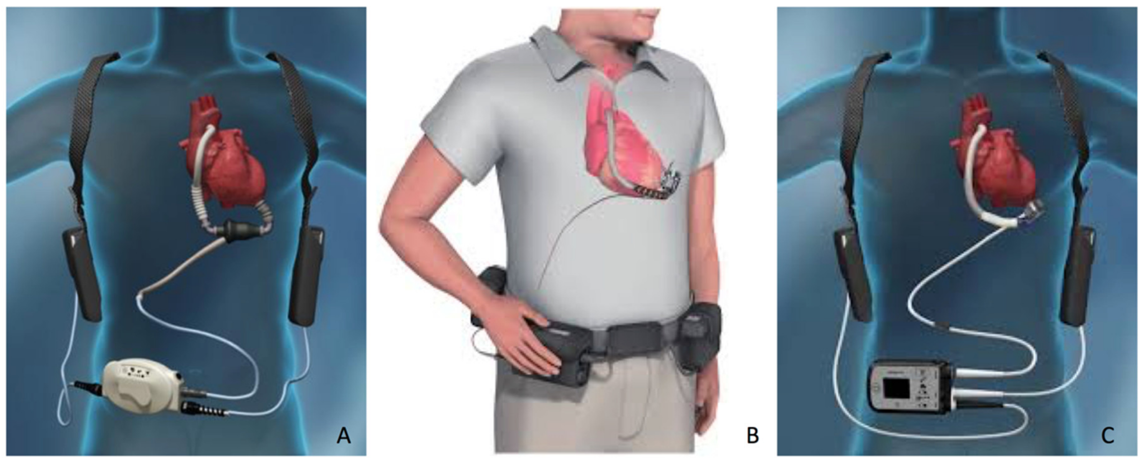 Hearts 02 00010 g001