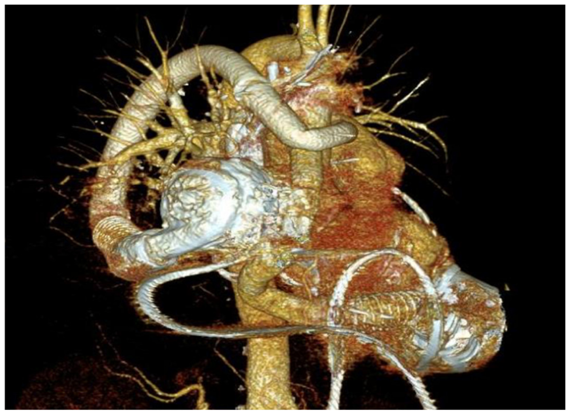 Hearts 02 00010 g003