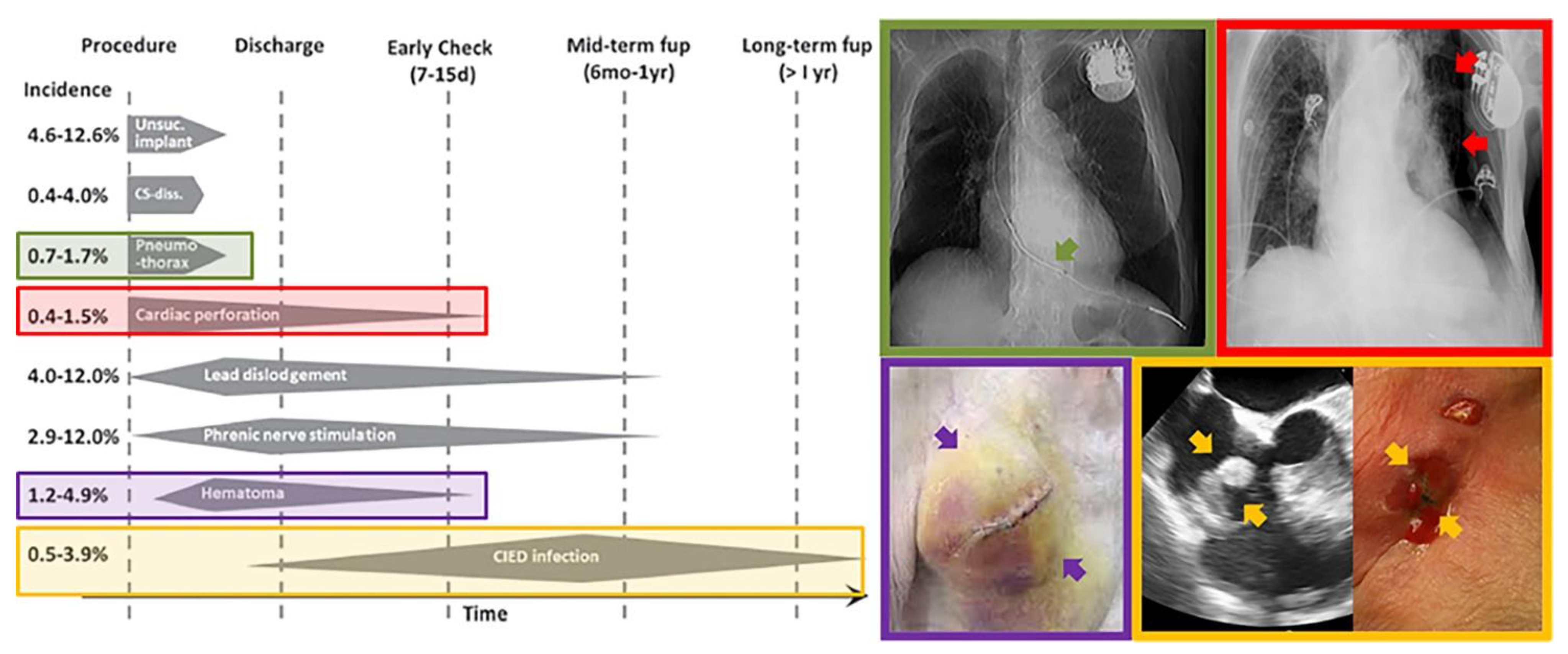 Hearts 02 00016 g001 Hearts 02 00016 g001