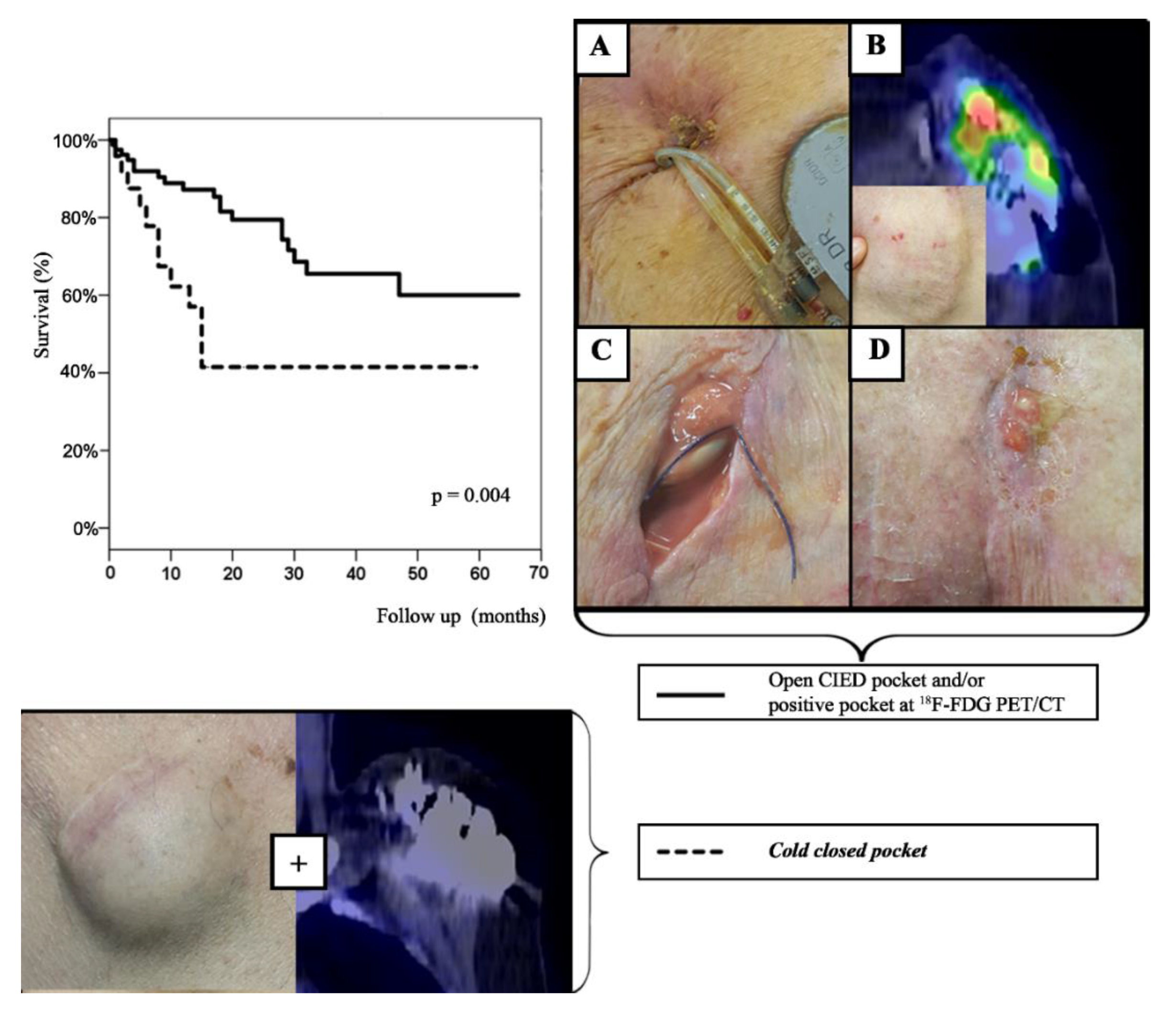 Hearts 02 00016 g004 Hearts 02 00016 g004