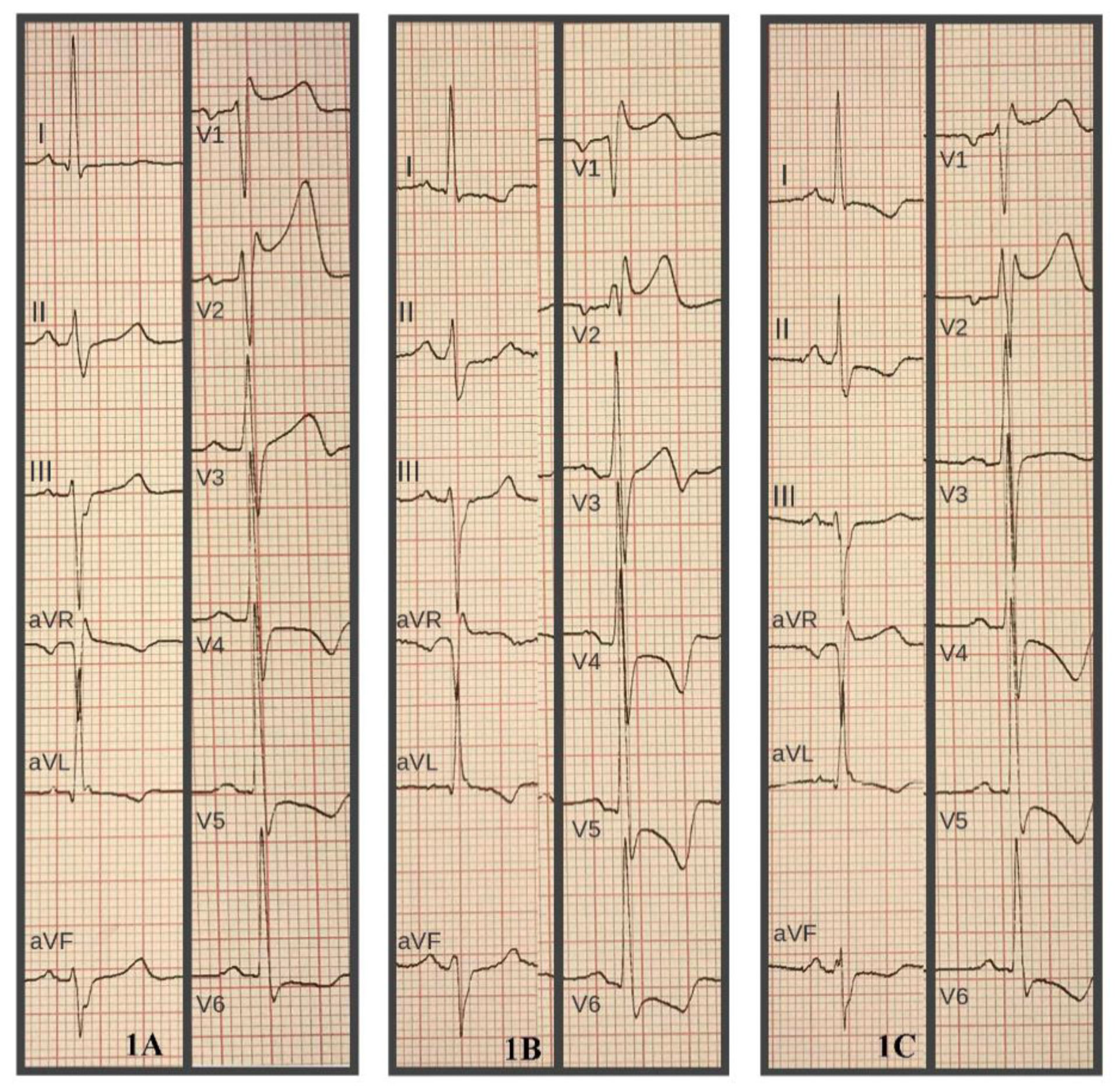 Hearts 02 00030 g001