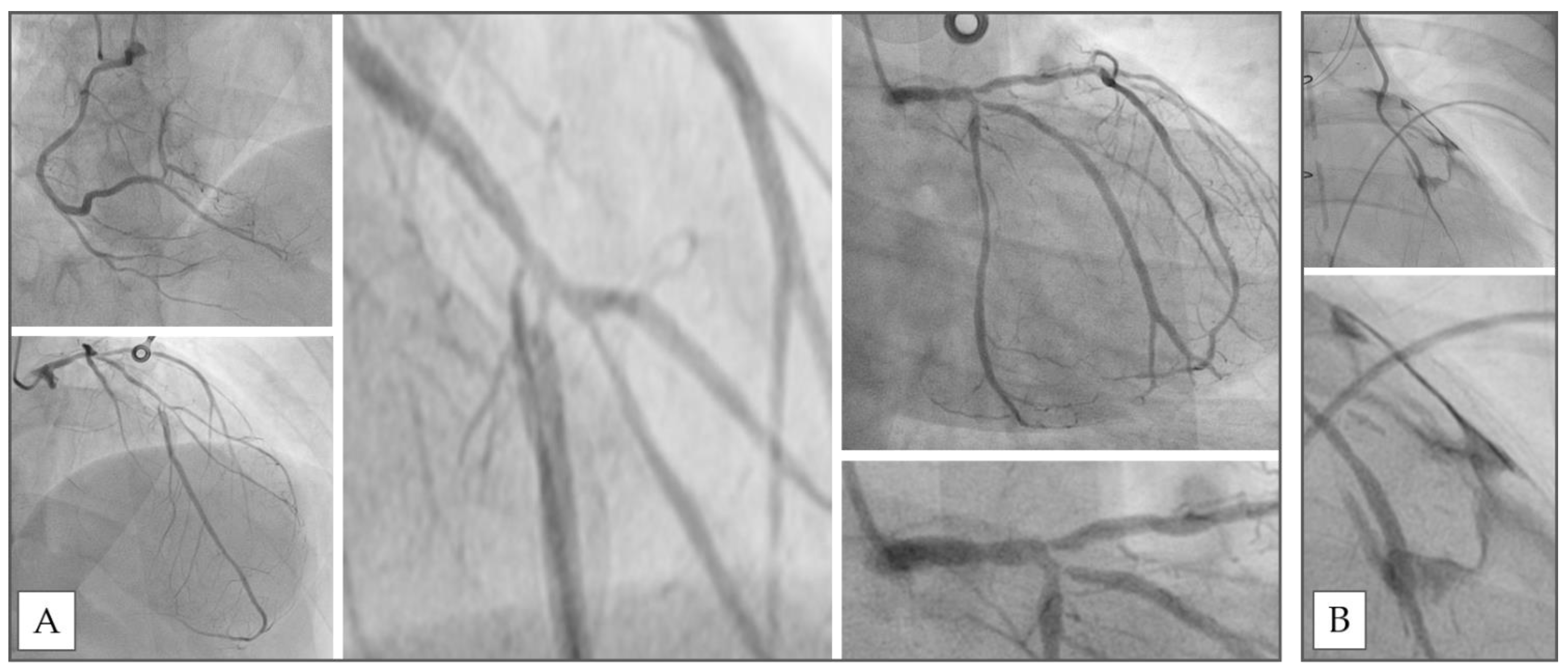 Hearts 02 00030 g002