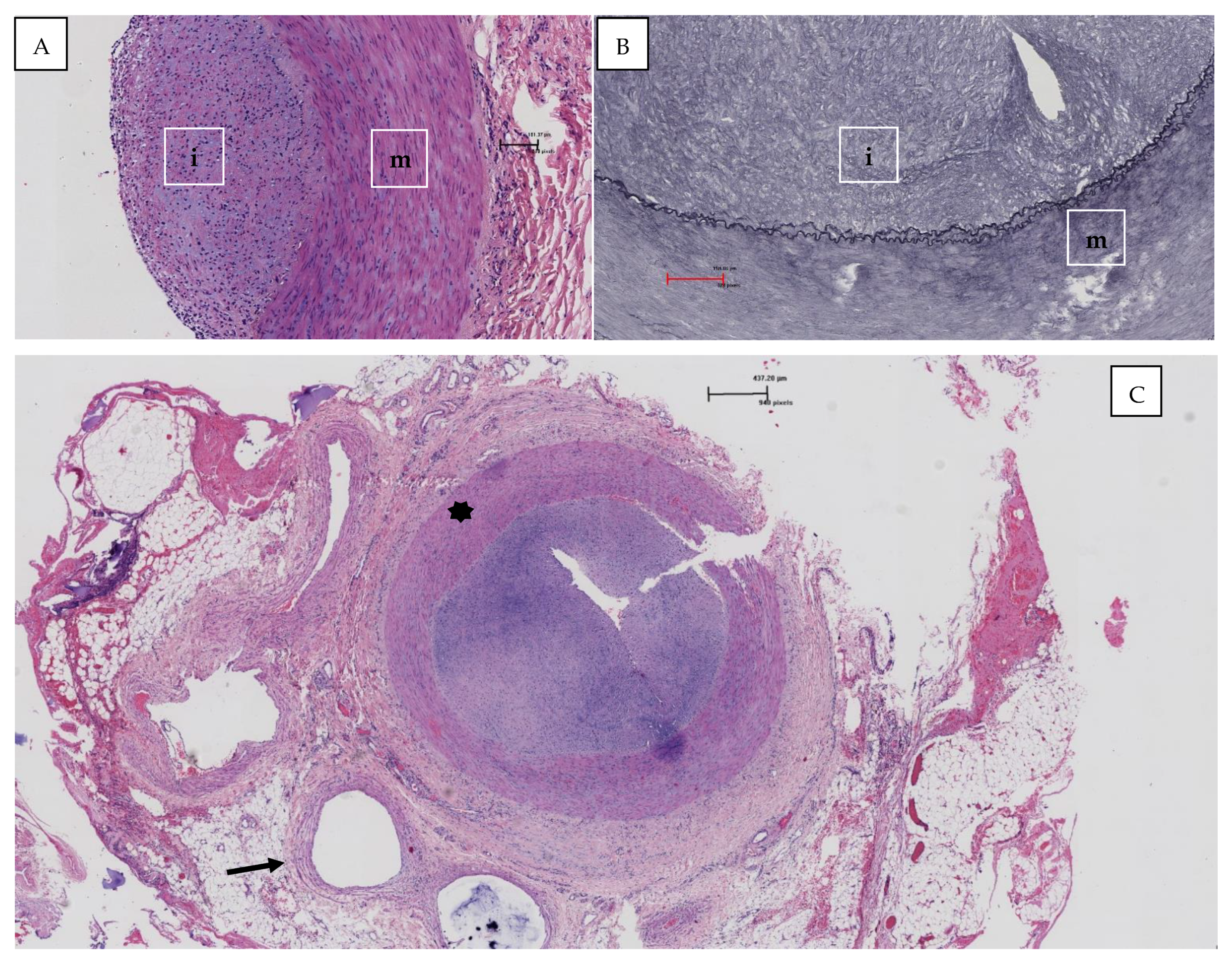 Hearts 02 00030 g003