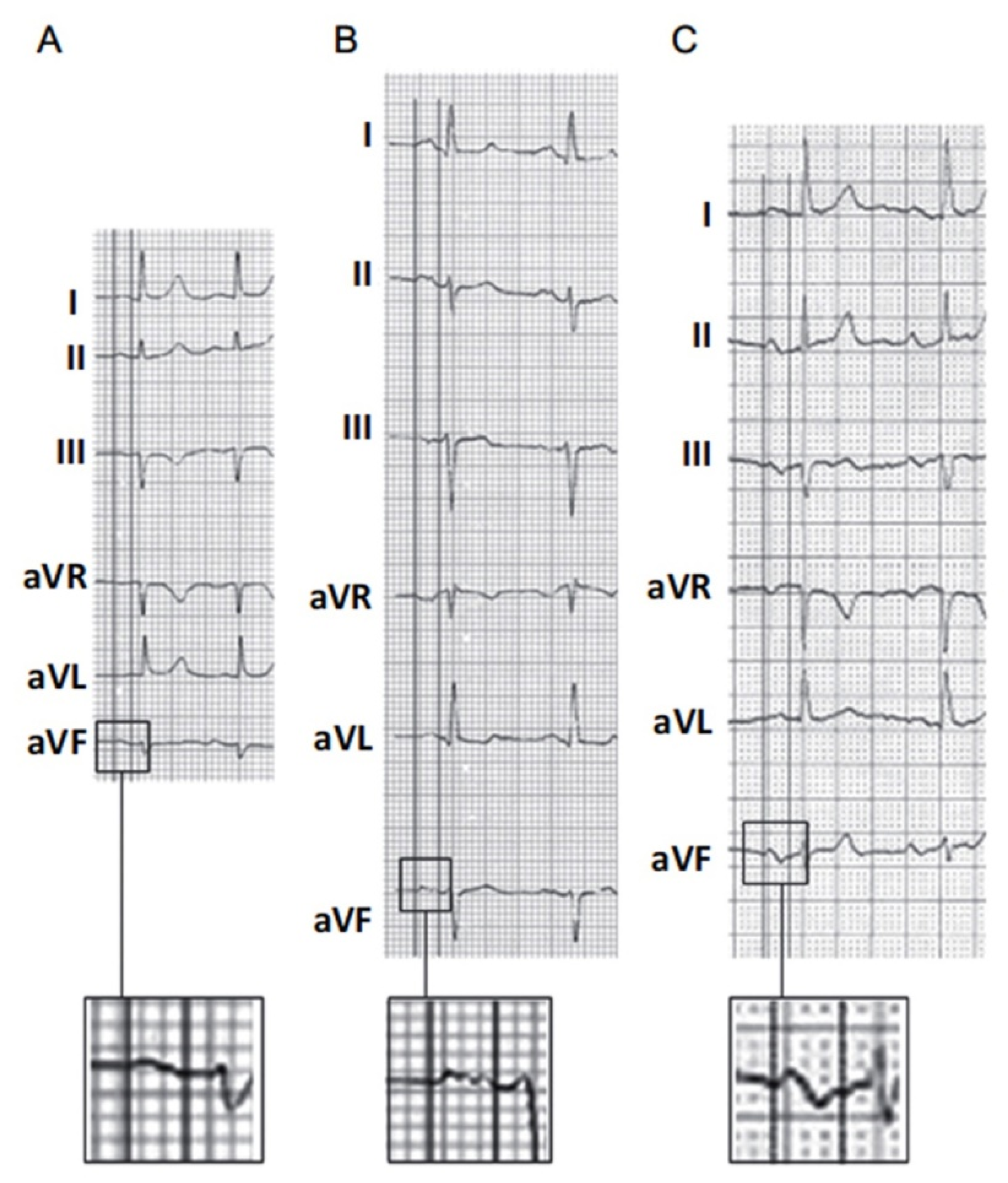 Hearts 02 00033 g003