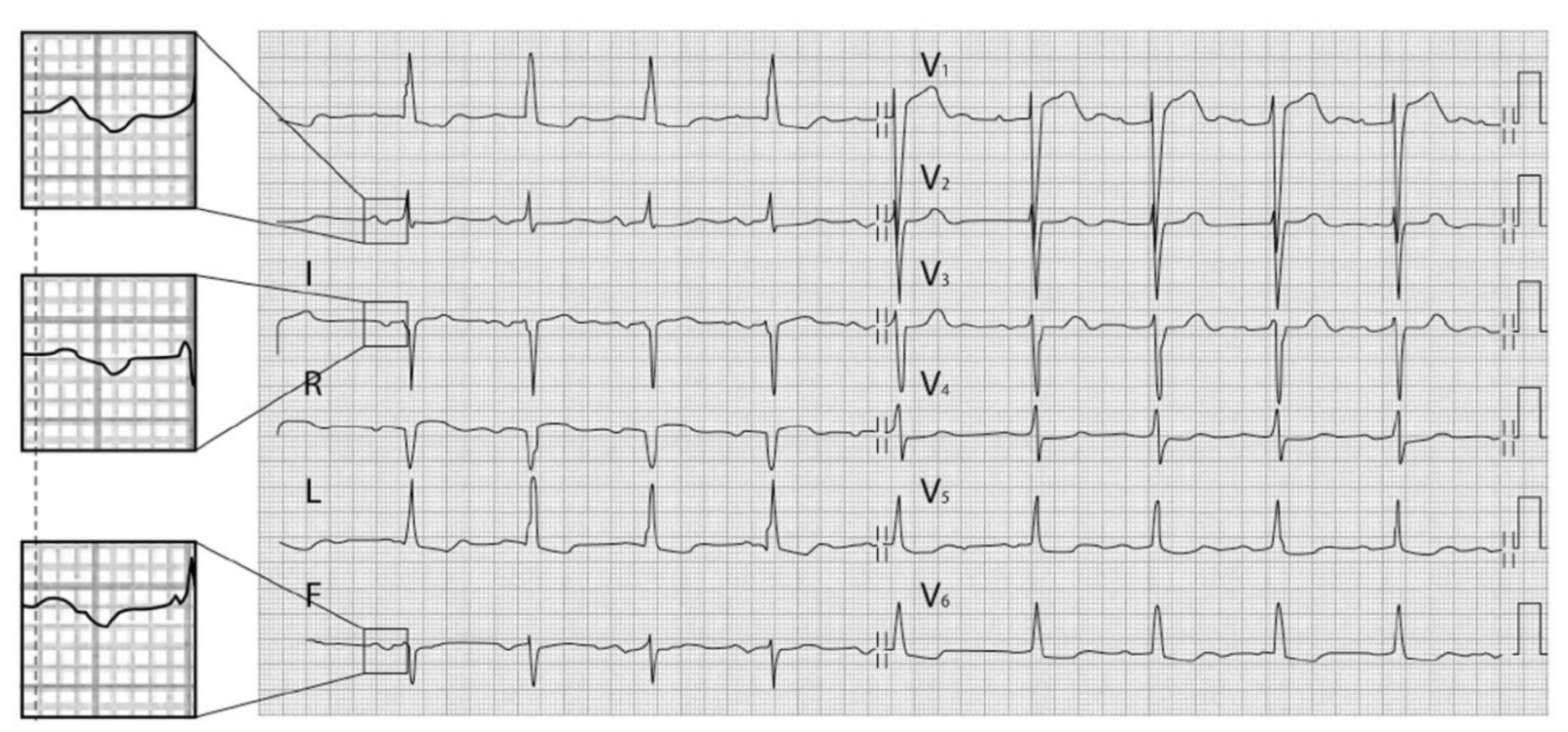 Hearts 02 00033 g004