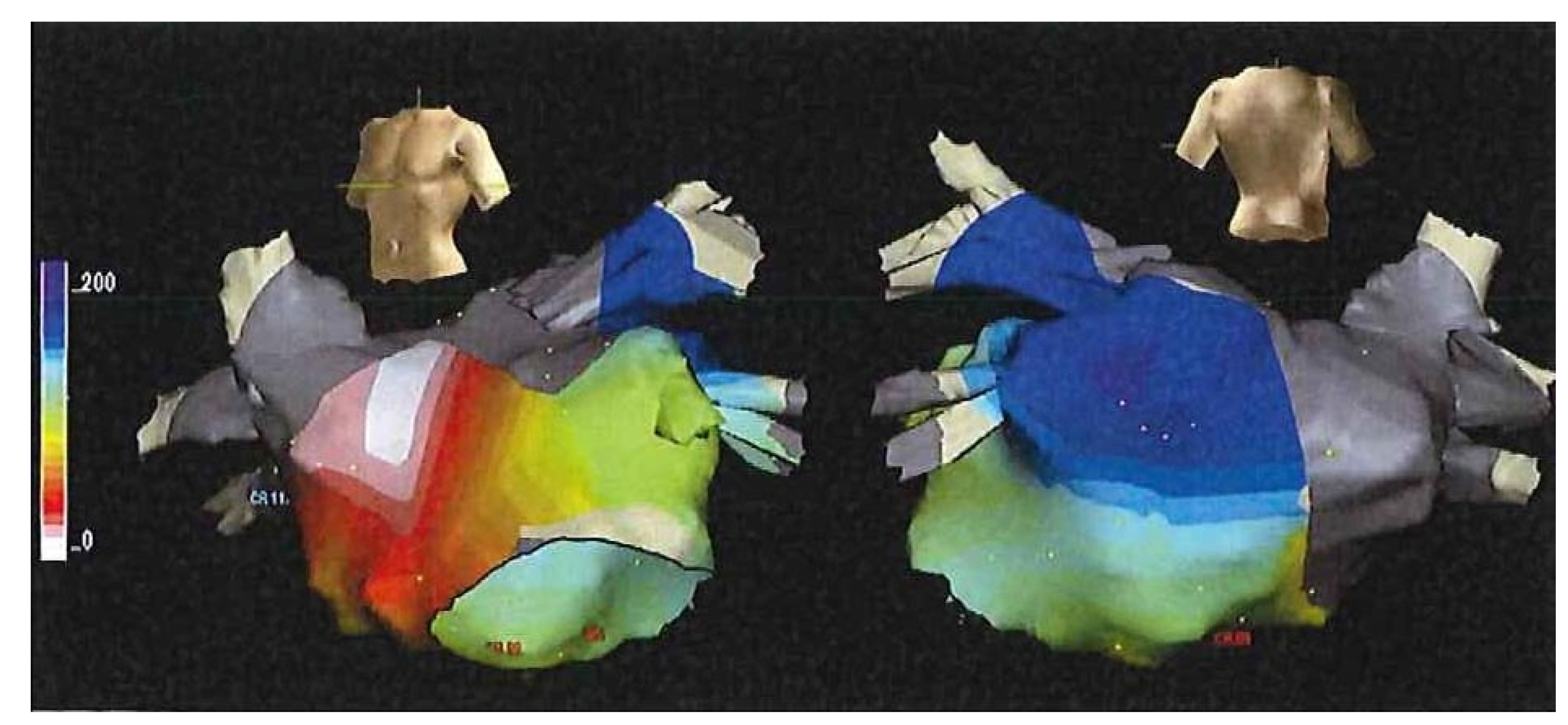 Hearts 02 00033 g006