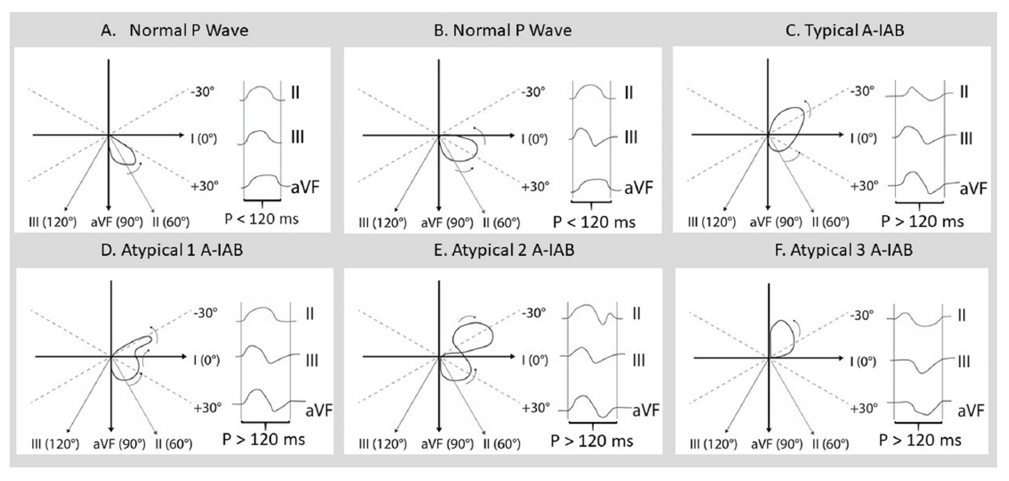 Hearts 02 00033 g009