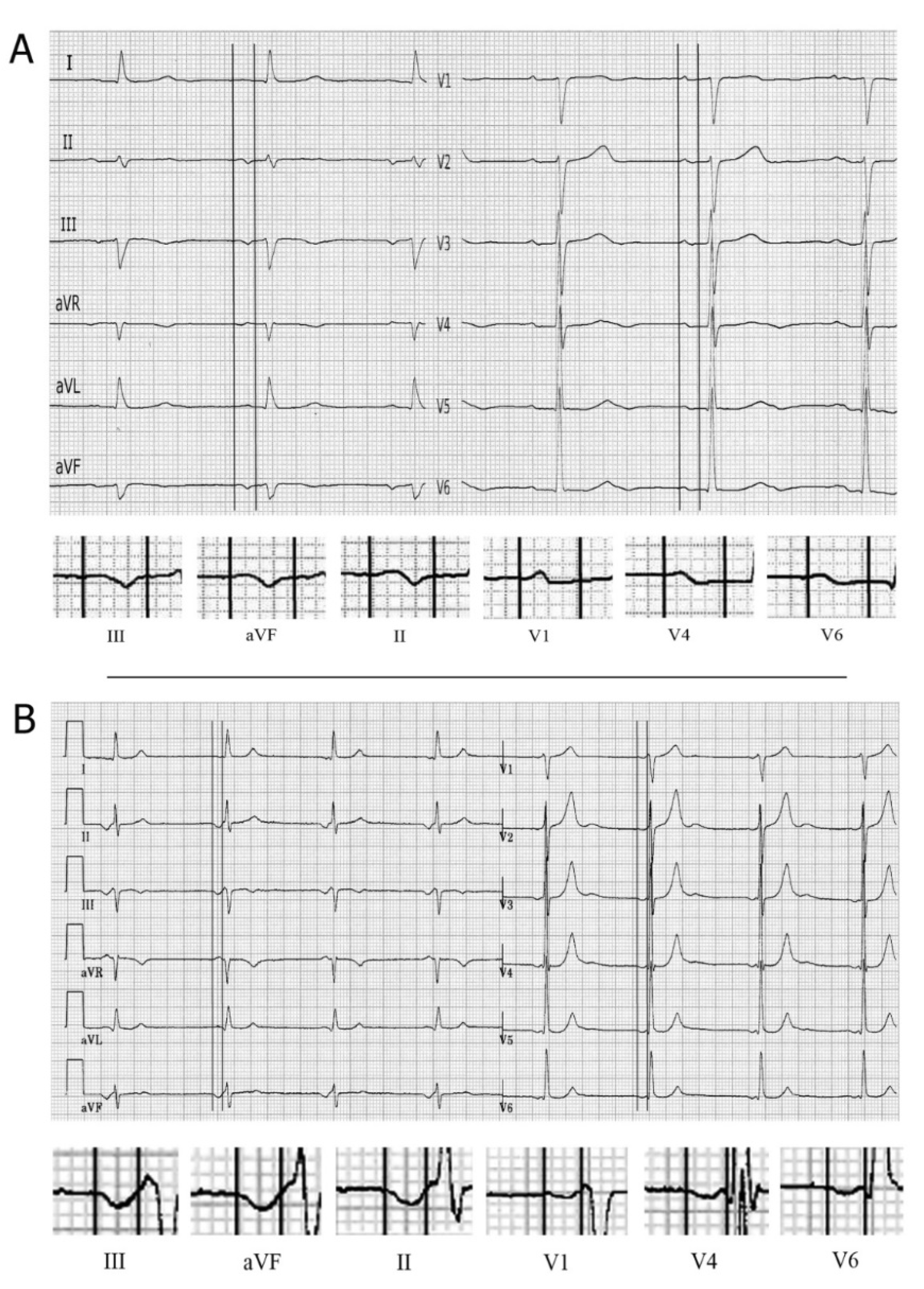 Hearts 02 00033 g010